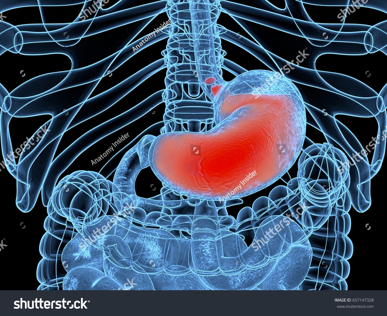 Acid Reflux Gerd Gastroesophageal Reflux Disease Stock Illustration ...