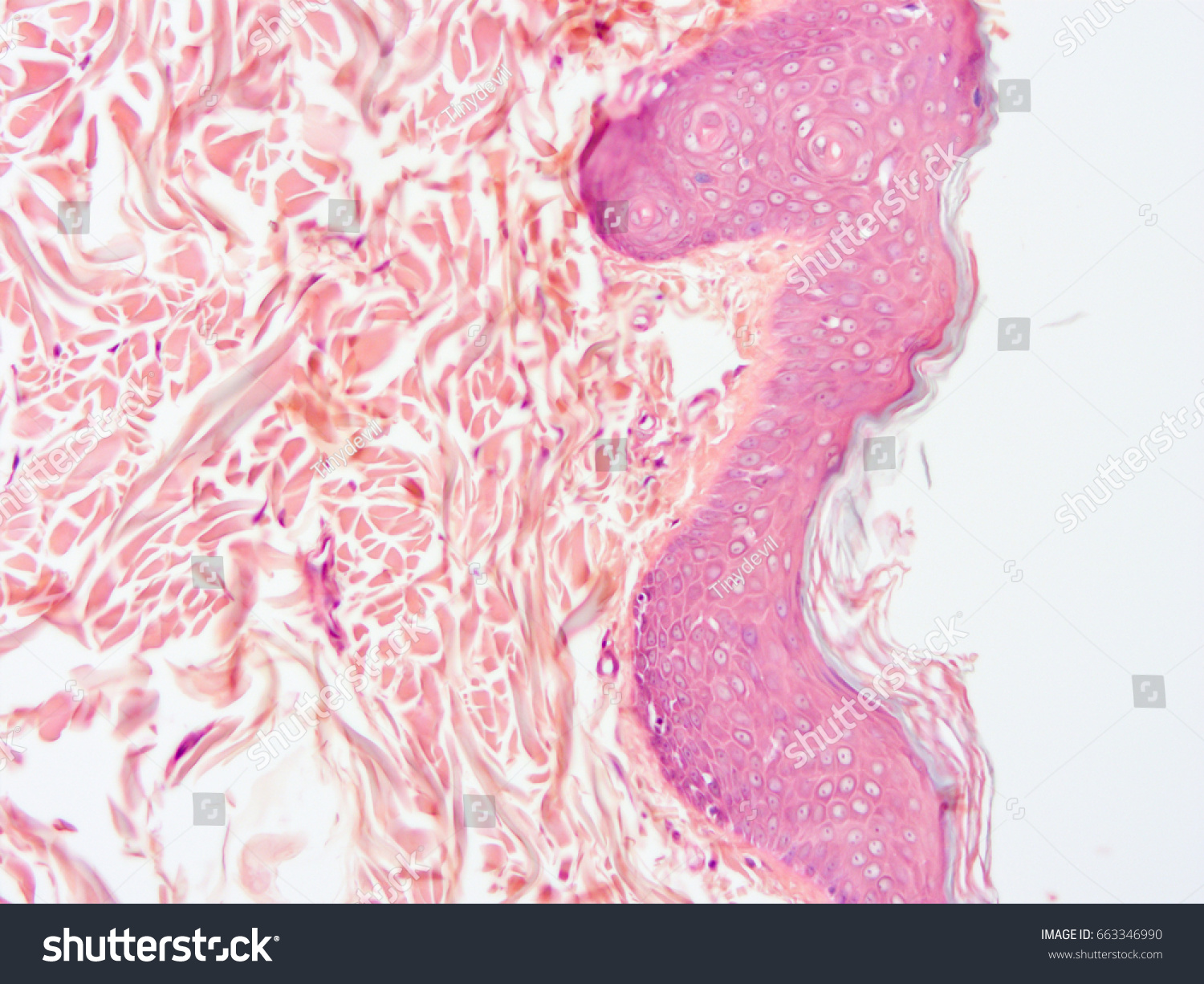 Histology Scalp Hair Follicle Human Tissue Stock Photo 663346990 ...