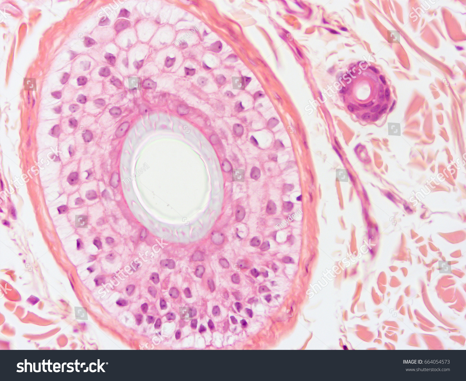 Histology Scalp Hair Follicle Human Tissue Stock Photo 664054573