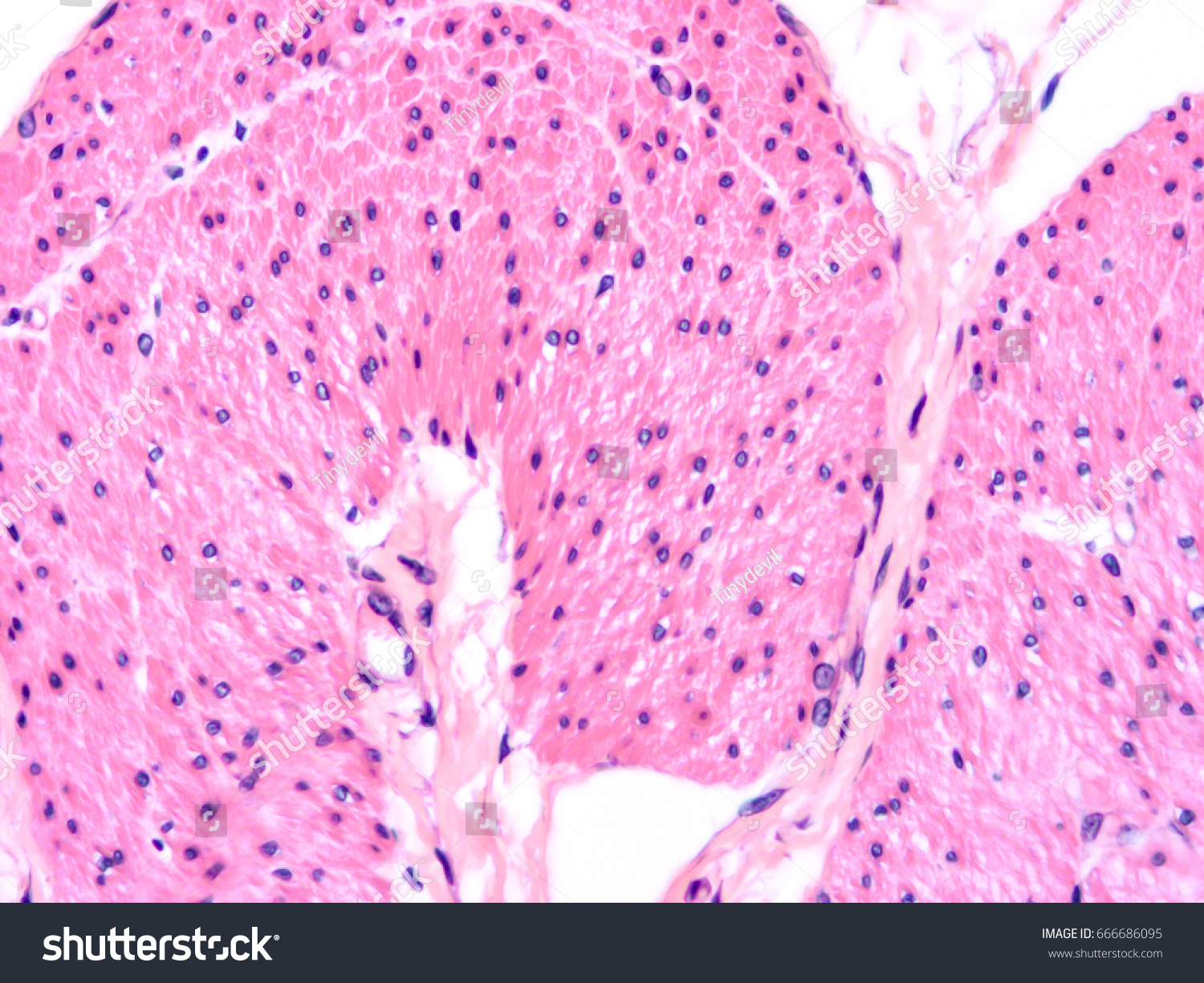 Histology Colon Human Tissue Show Epithelium Stock Photo 666686095 ...