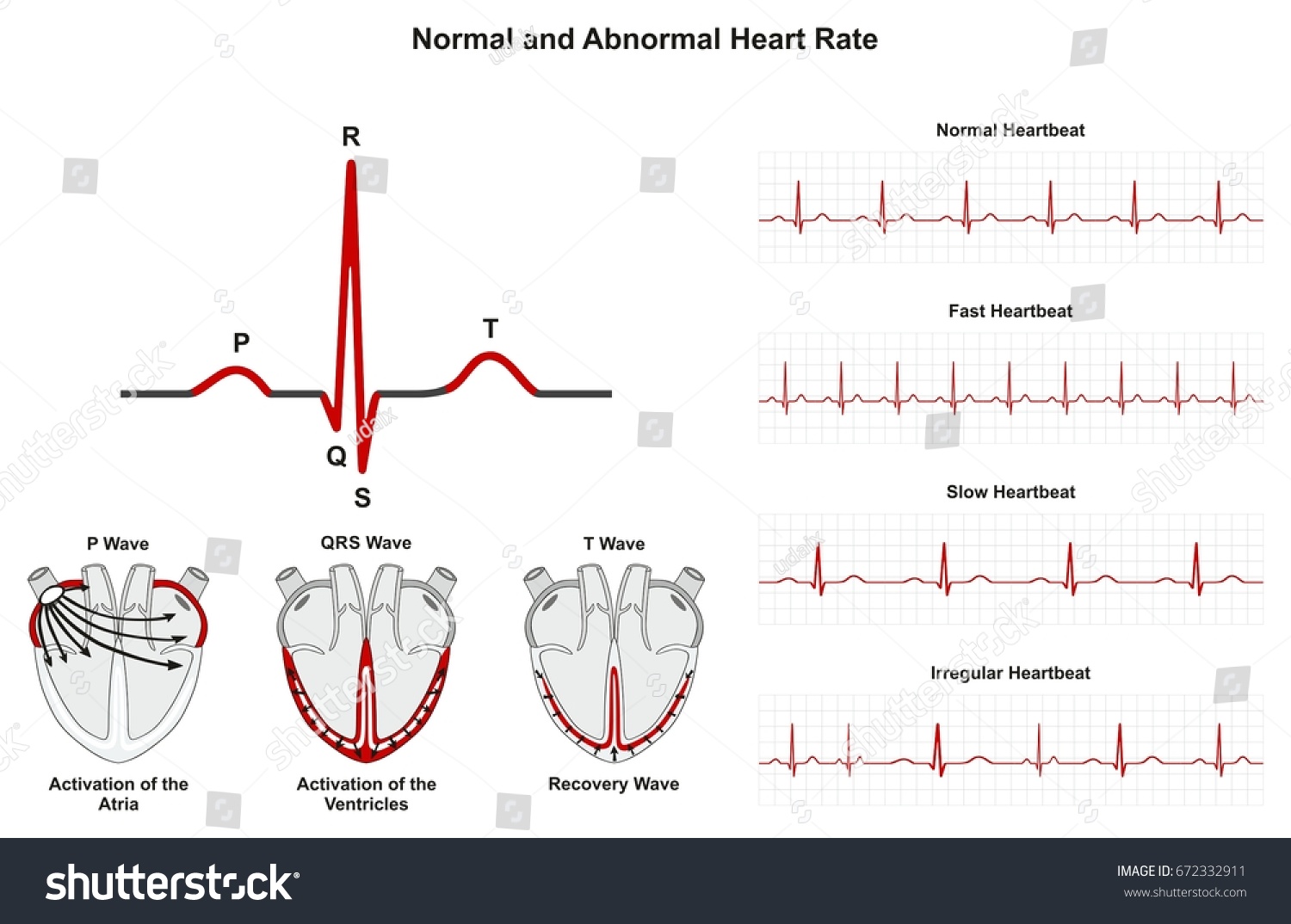 normal-abnormal-heart-rate-infographic-diagram-672332911