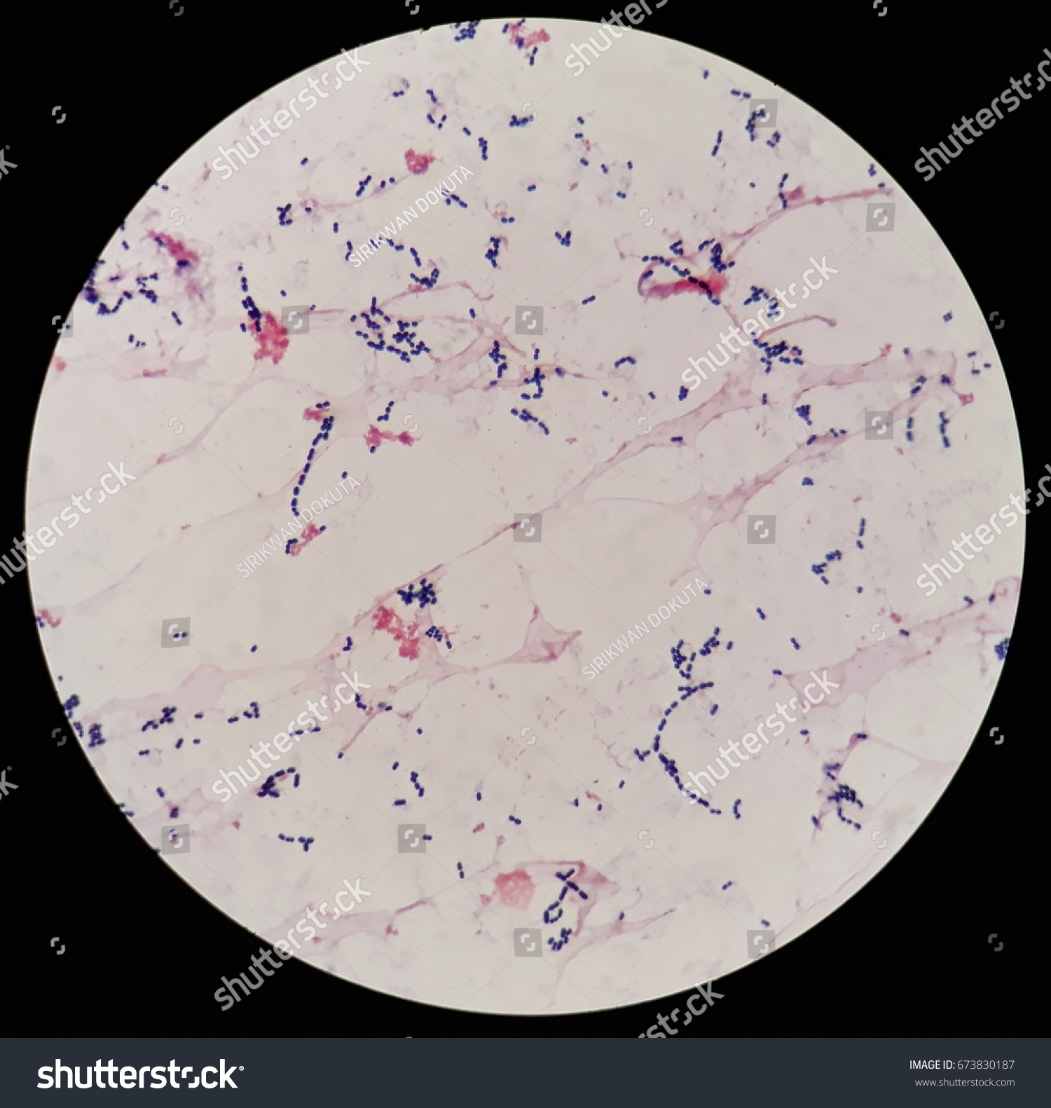 Smear Human Blood Cultured Grams Stained Stock Photo 673830187 ...