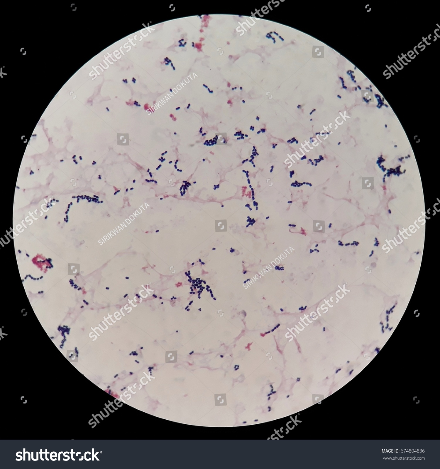 cocci bacteria under microscope