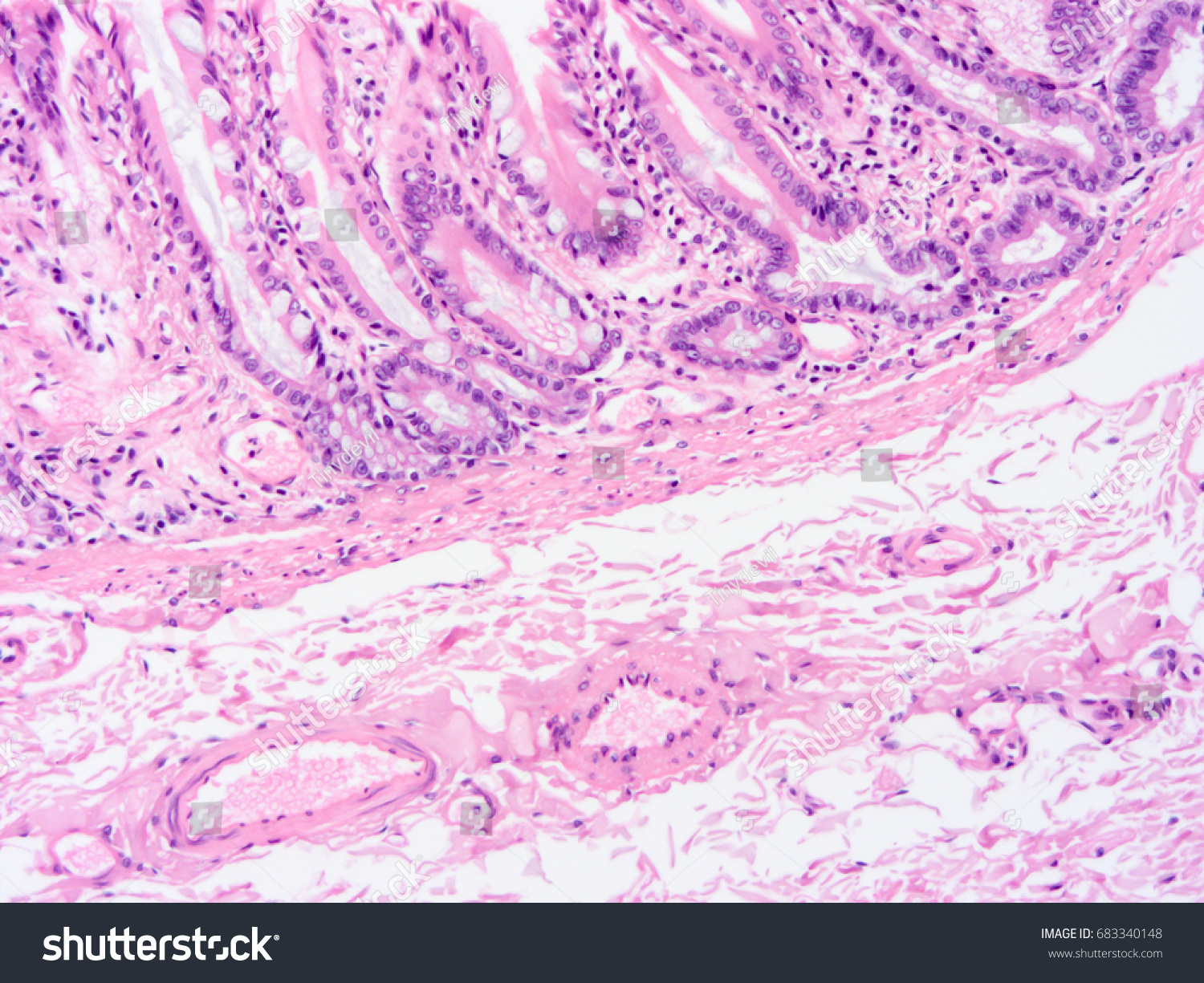 Histology Intestine Human Tissue Show Epithelium Stock Photo 683340148 ...