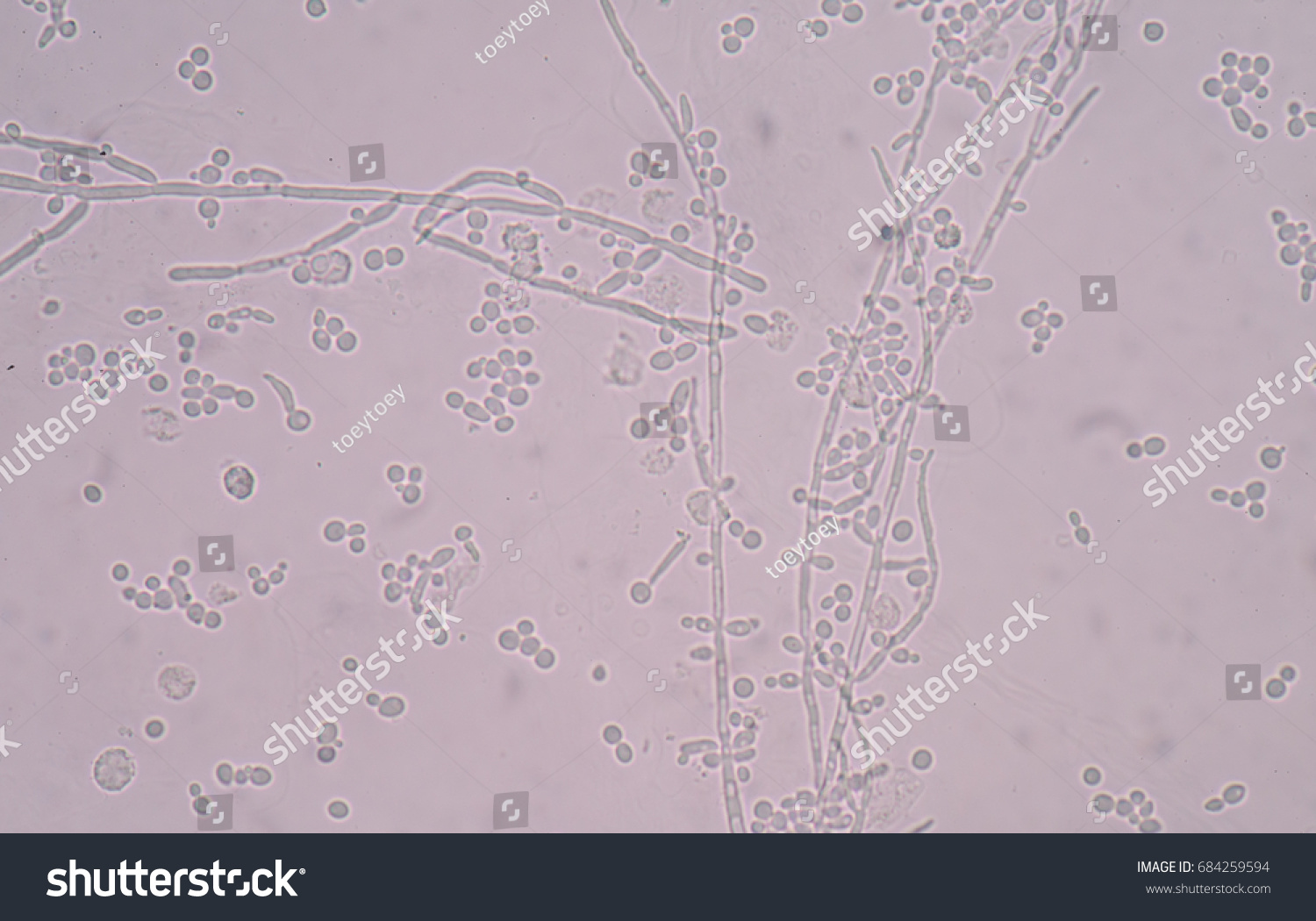 Budding Yeast Cell Structure Fine Microscope Stock Photo 684259594 ...