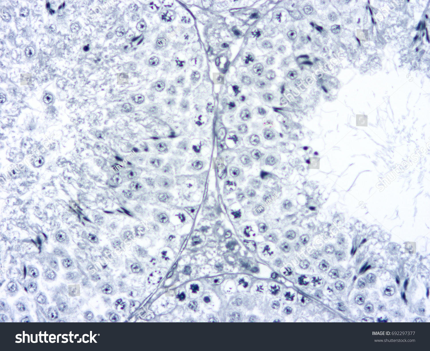 Histology Human Testis Tissue Show Spermatogenesis Stock Photo ...