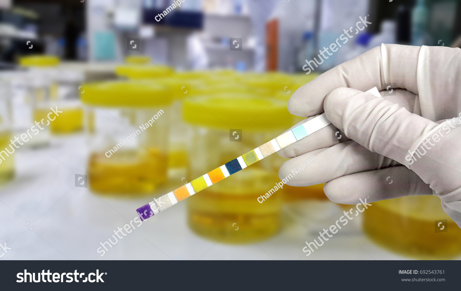 1554 Urinary Bacteria Görseli Stok Fotoğraflar Ve Vektörler Shutterstock 6911