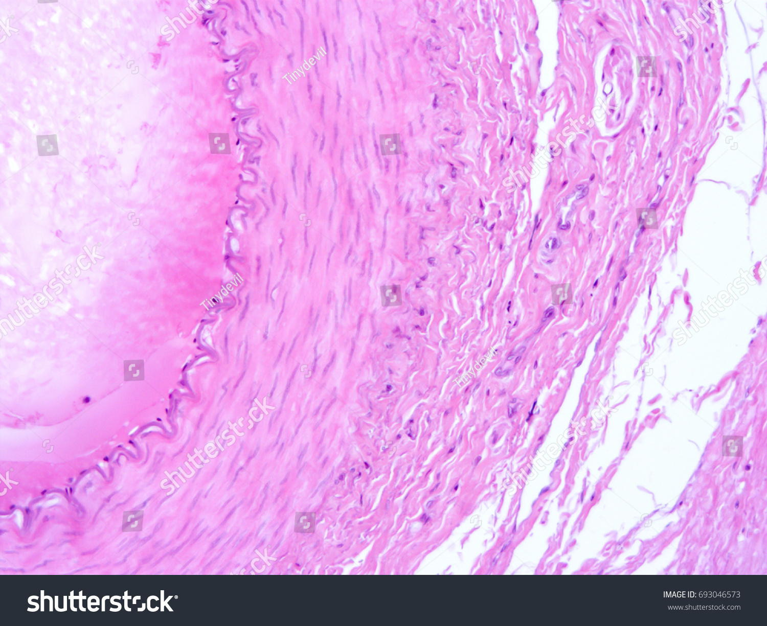 Histology Prostate Urethra Dog Tissue Show Stock Photo 693046573 ...