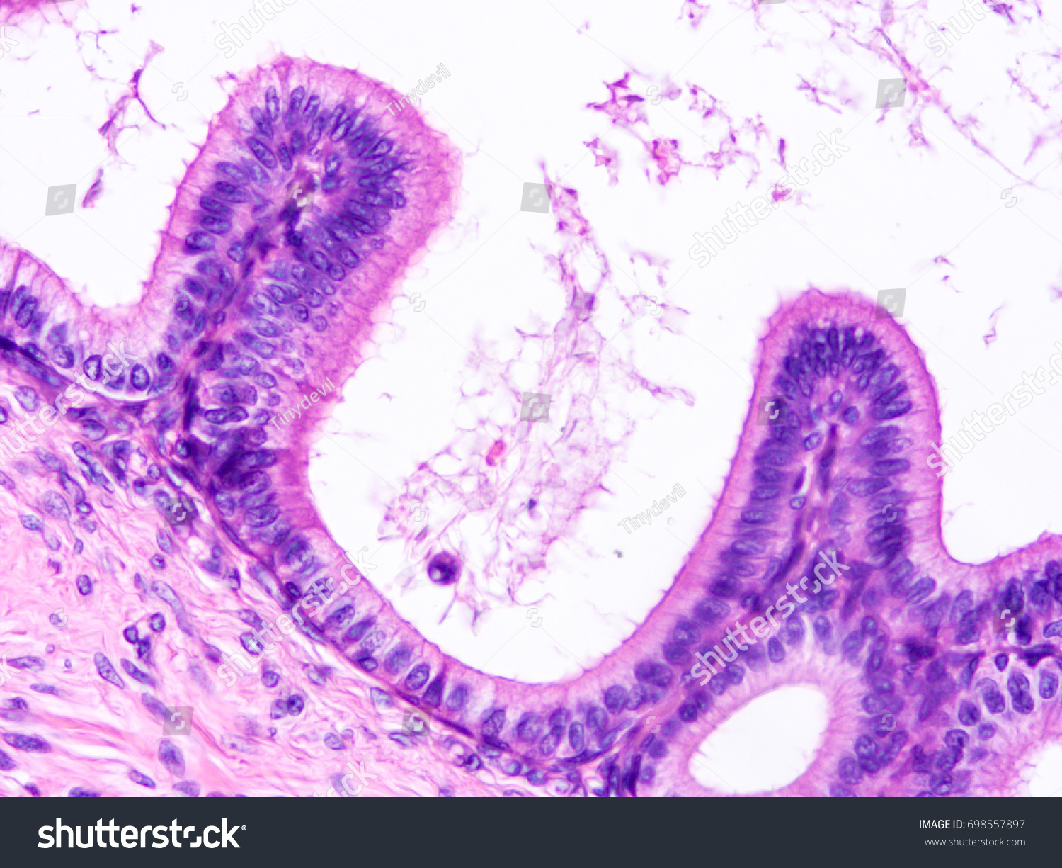 Histology Human Vasdeferens Tissue Show Epithelium Stock Photo ...