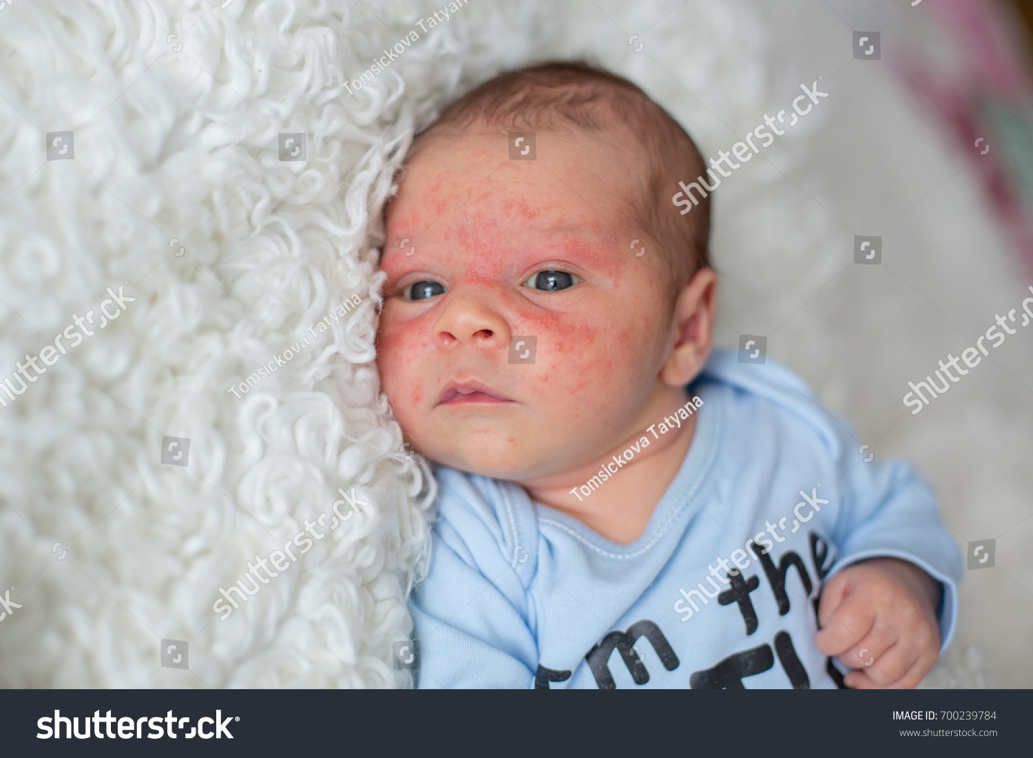 little-newborn-baby-looking-baby-skin-stock-photo-700239784-shutterstock