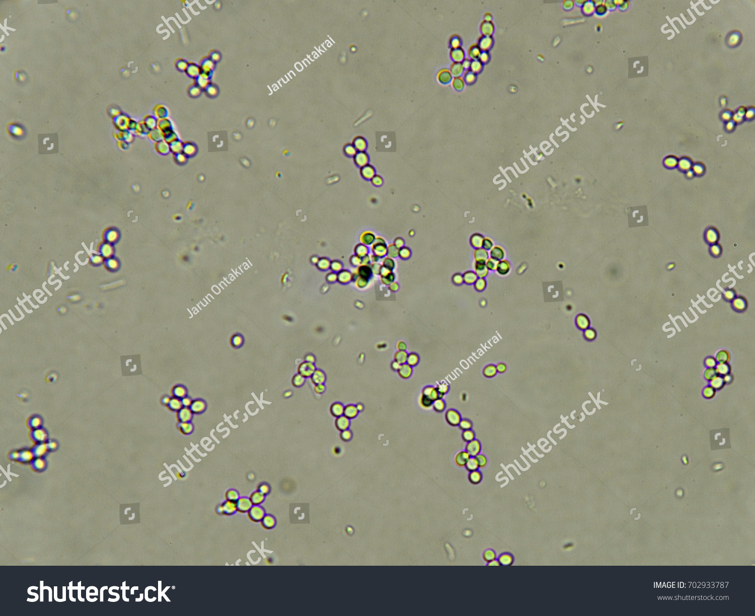 Budding Yeast Cells Patient Urine Urinary Stock Photo 702933787 ...