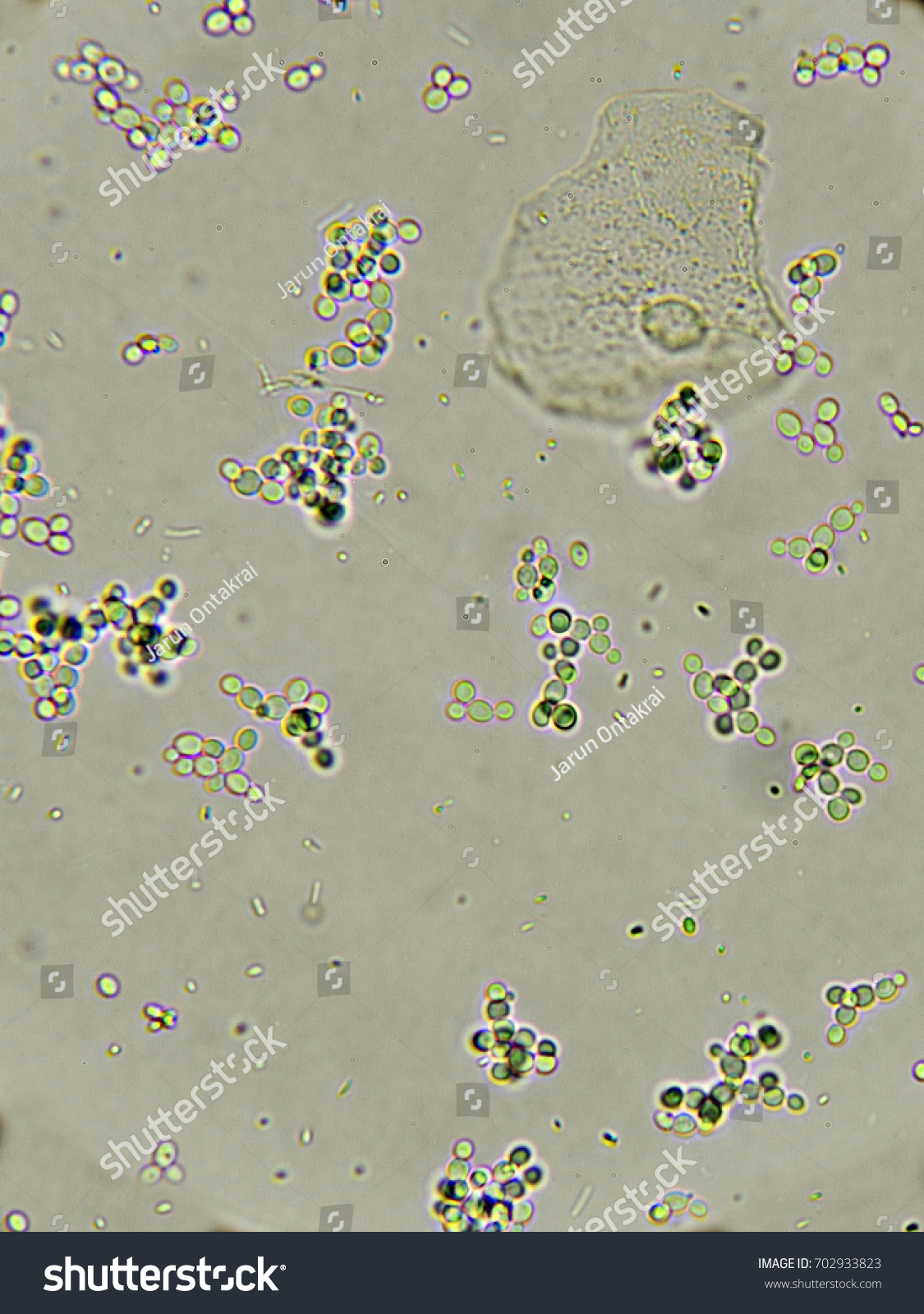 Budding Yeast Cells Patient Urine Urinary Stock Photo 702933823 ...