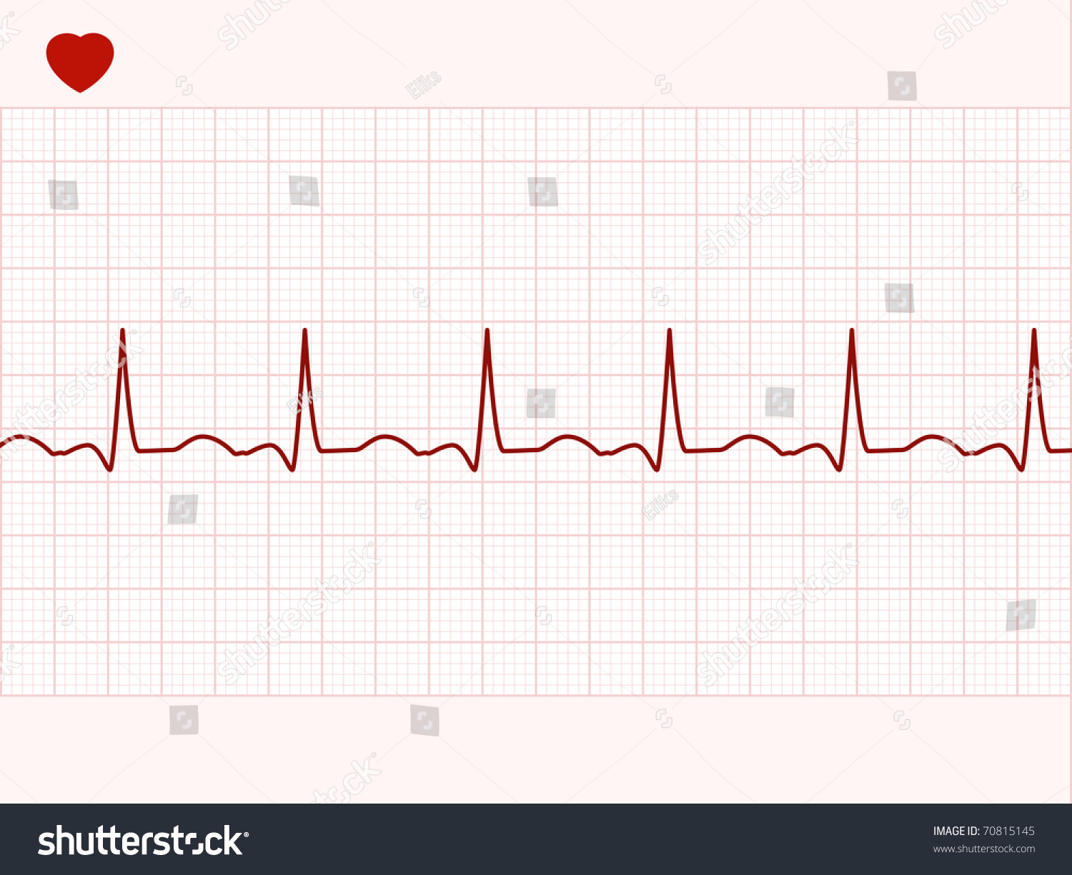 Normal Electronic Cardiogram Eps 8 Vector Stock Vector (Royalty Free ...