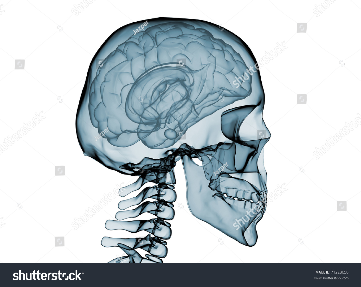 Xray Brain Skeletonisolated On White Background Stock Illustration ...