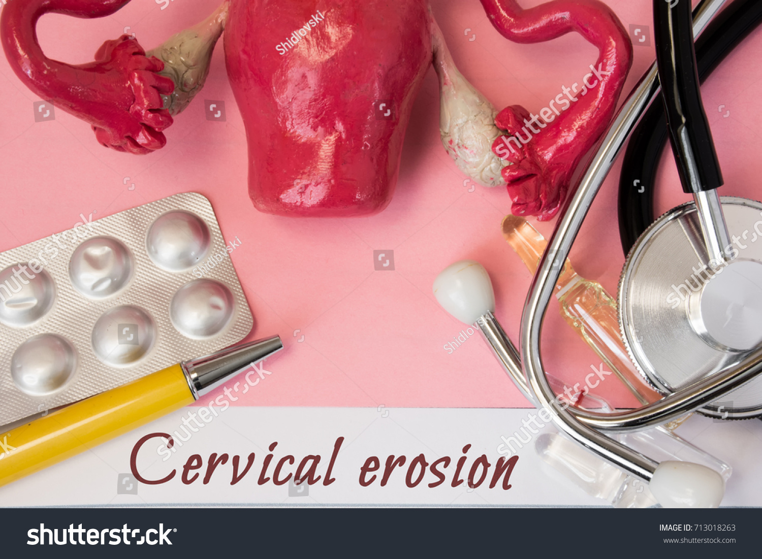 Стоковая фотография 713018263: Diagnosis Cervical Erosion Medical History P...