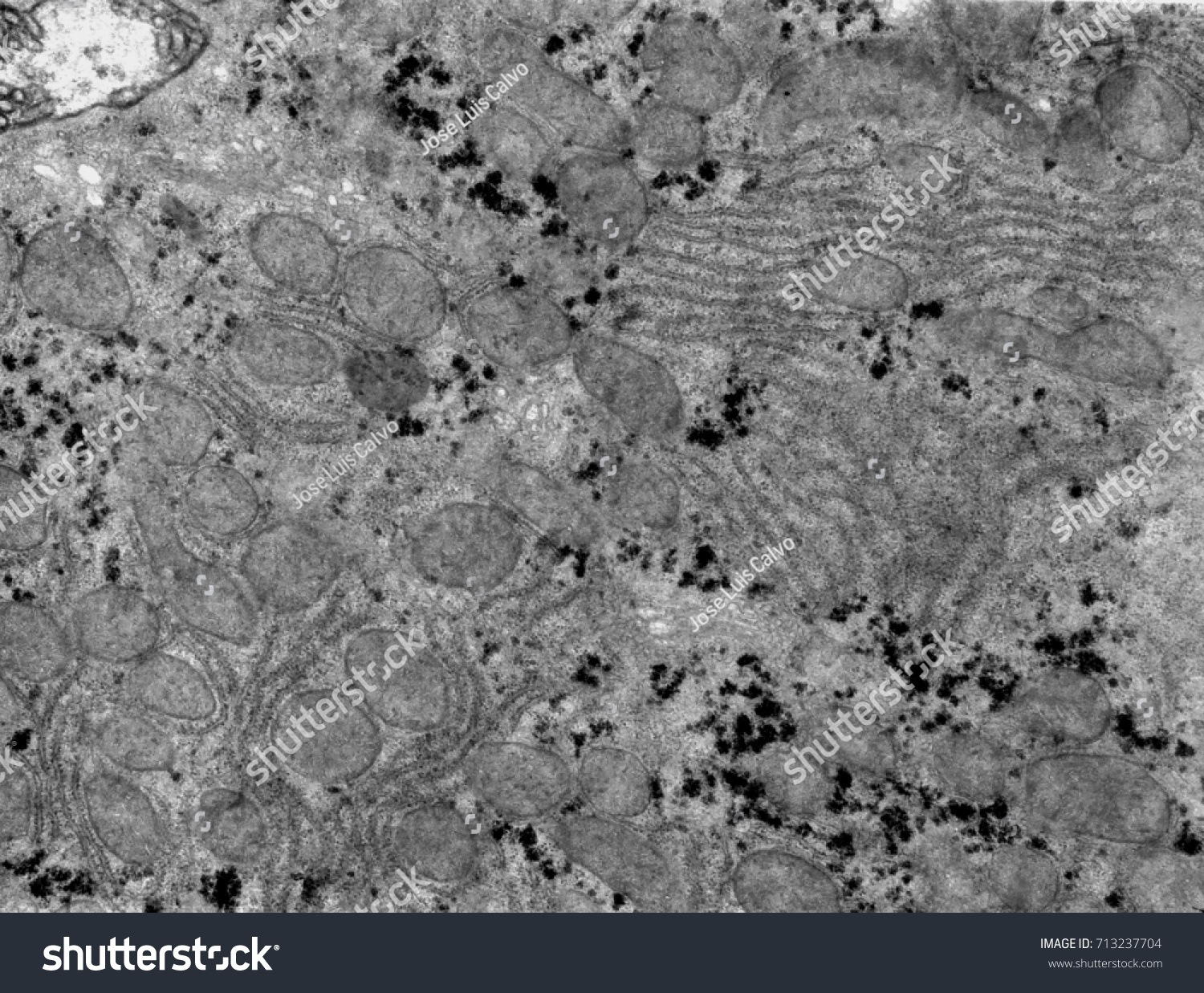Transmission Electron Microscope Tem Micrograph Showing Stock Photo ...