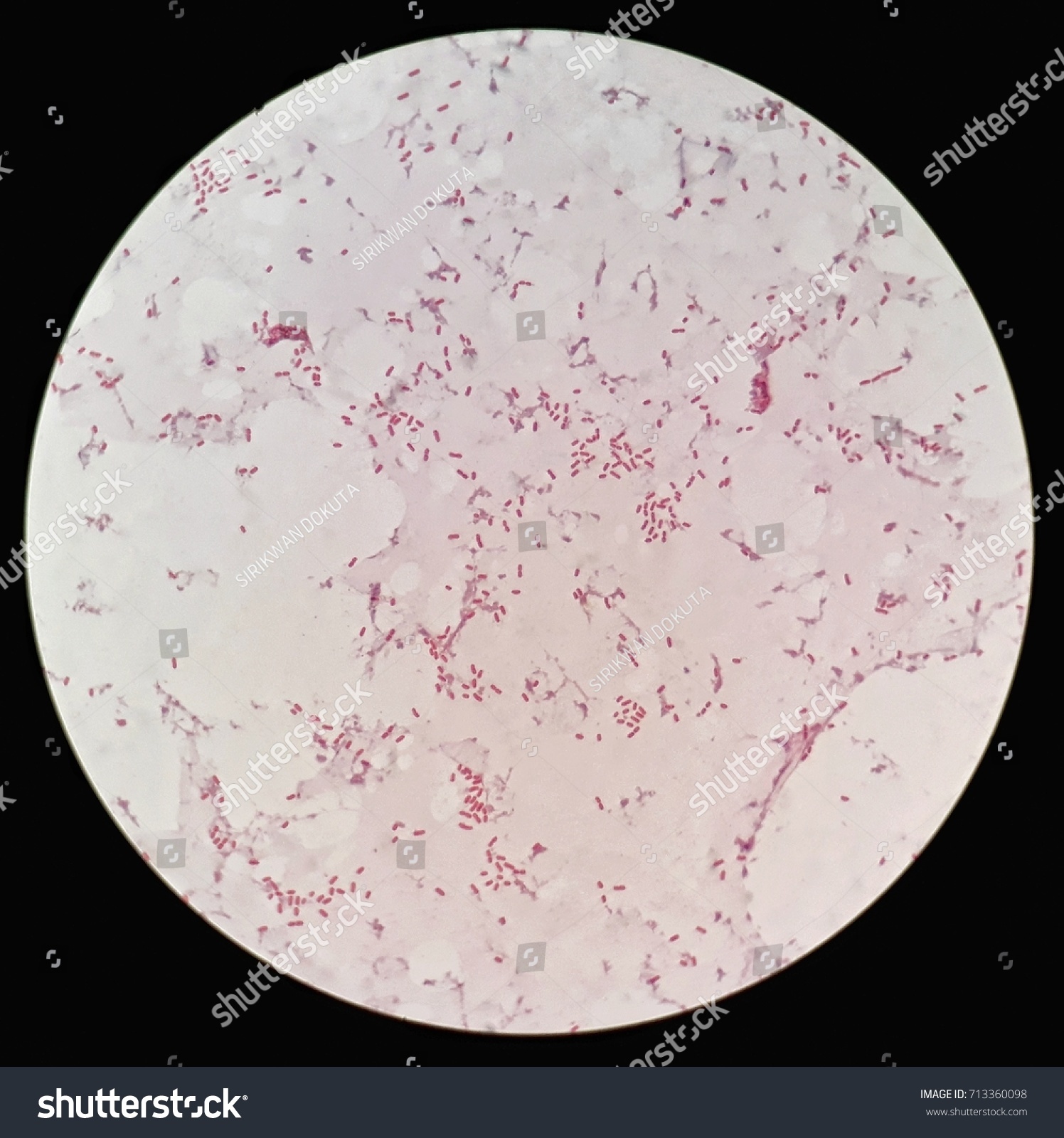 Smear Human Blood Culture Grams Stained Stock Photo 713360098 ...