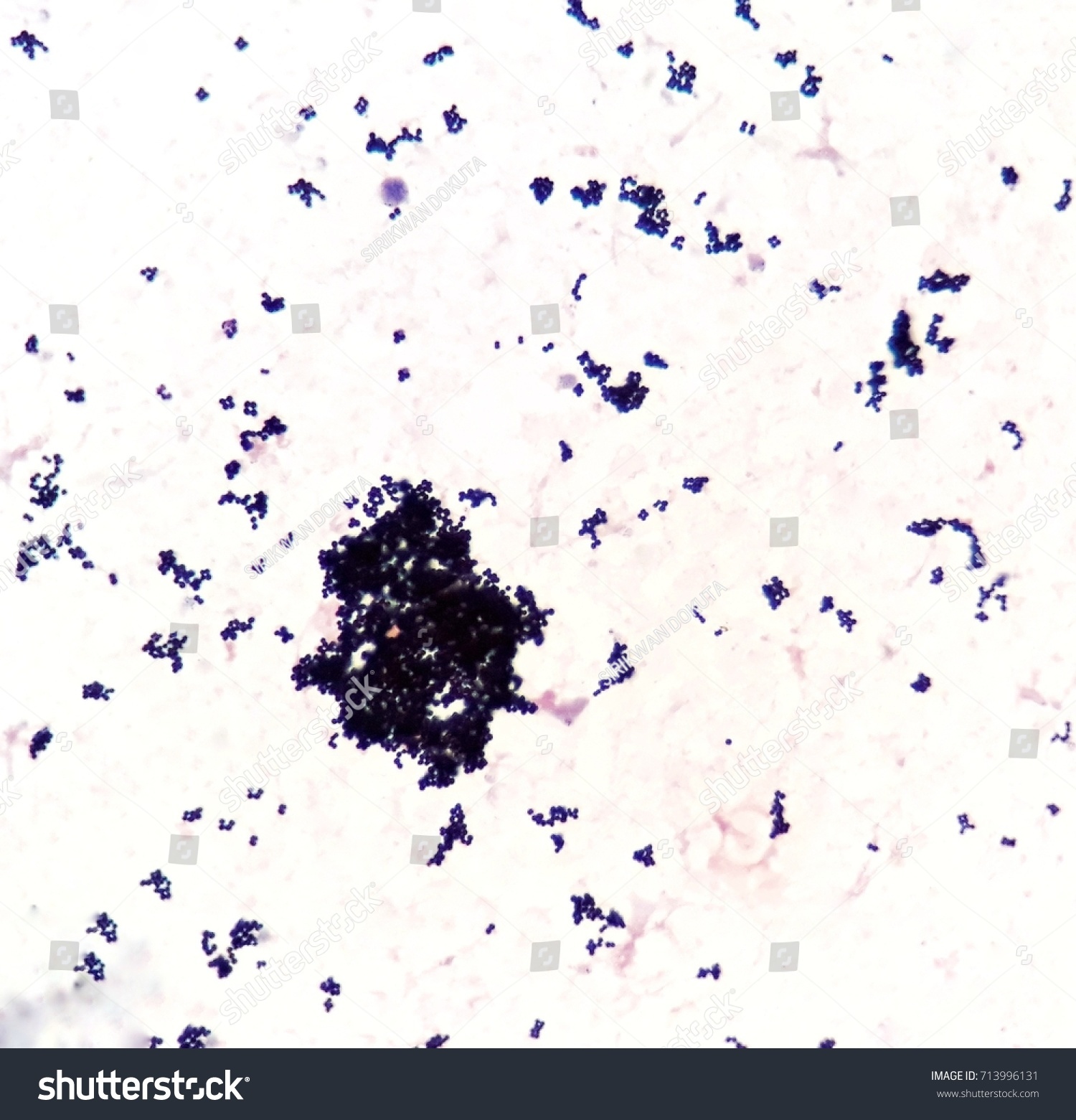 Smear Human Blood Culture Grams Stained Stock Photo 713996131 ...