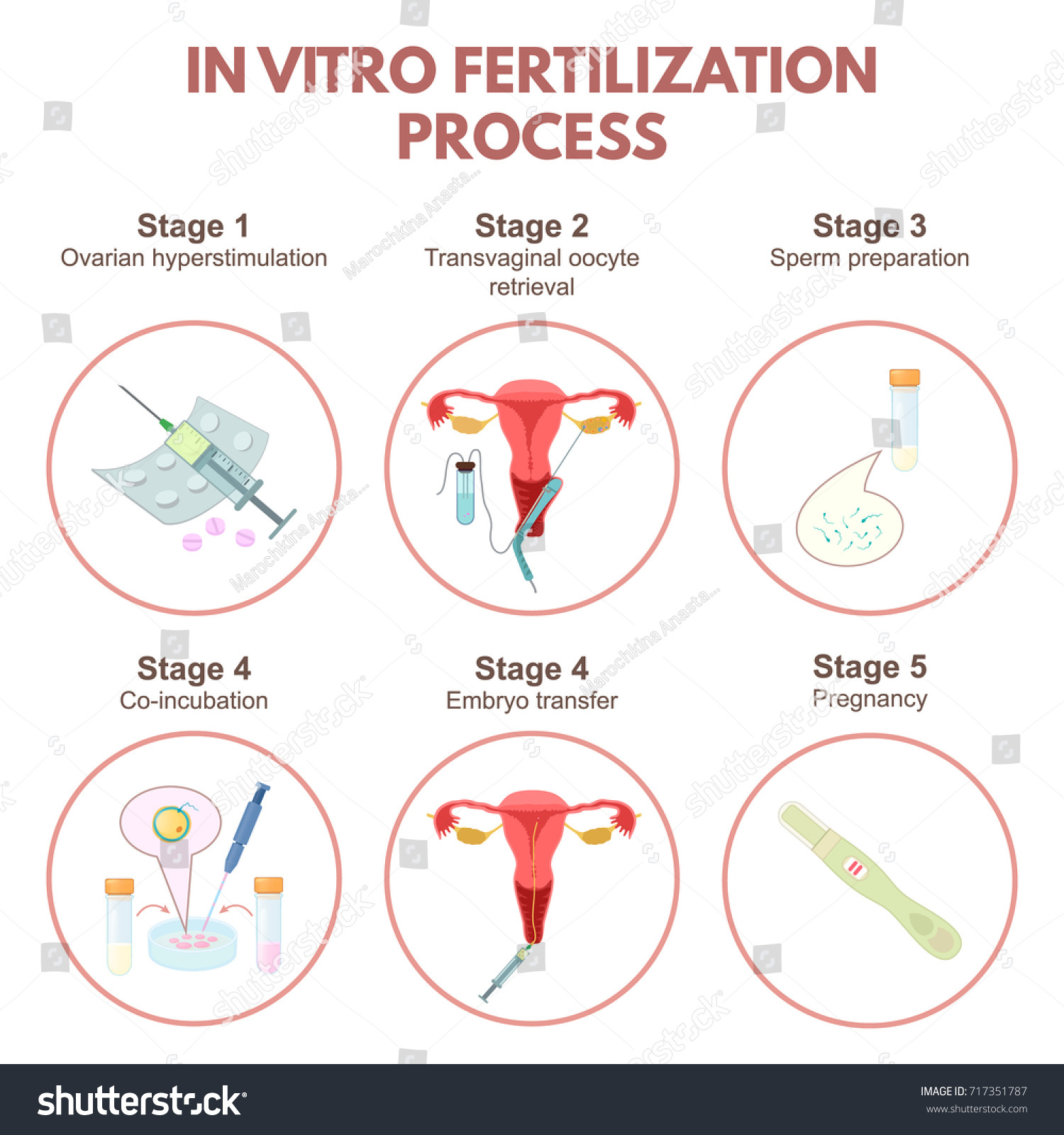 Vitro Fertilization Stepbystep Method Stages Artificial Stock Vector Royalty Free 717351787 9734