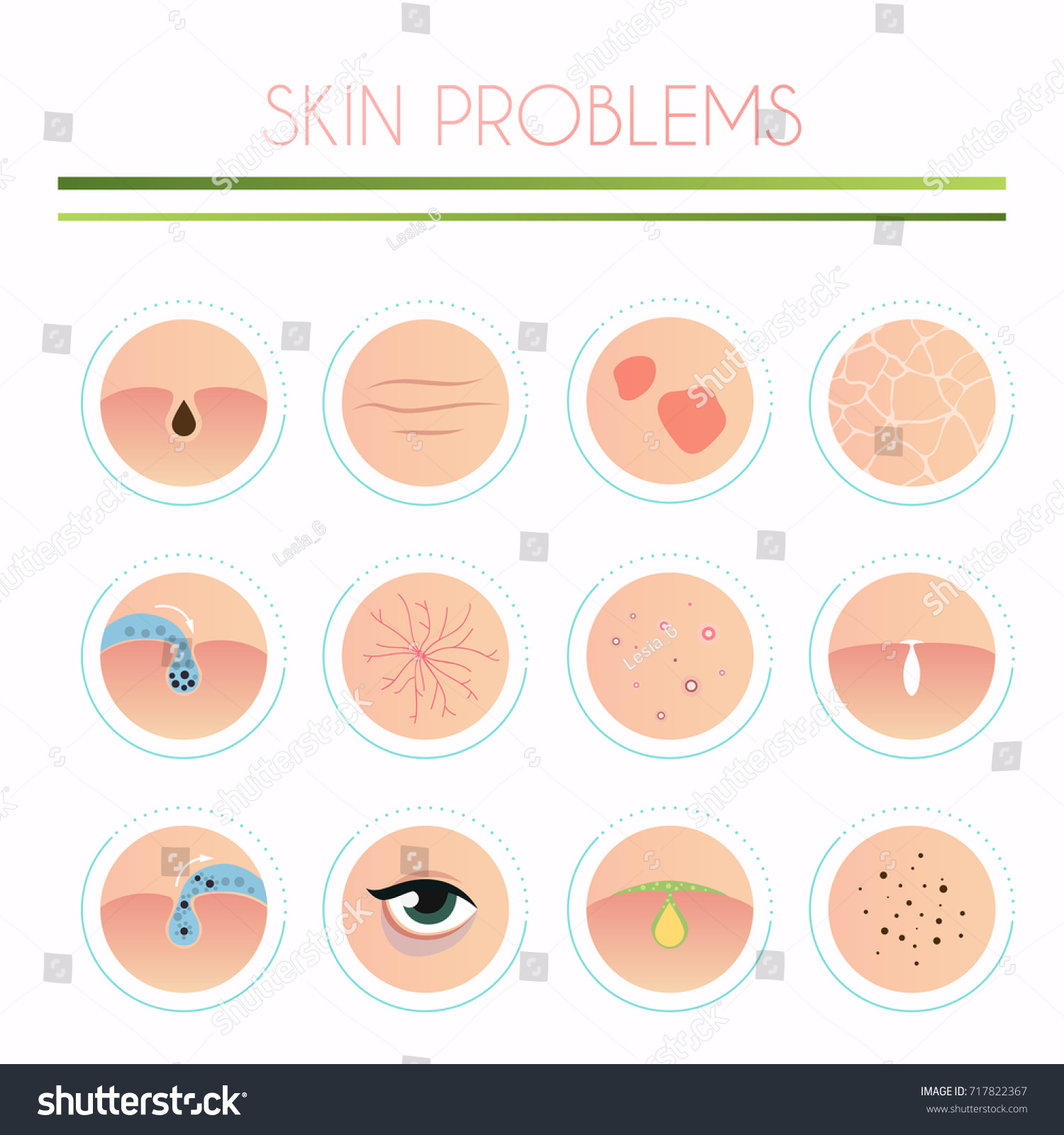 Skin Problems Solution Home Remedies Skincare Stock Vector (Royalty ...