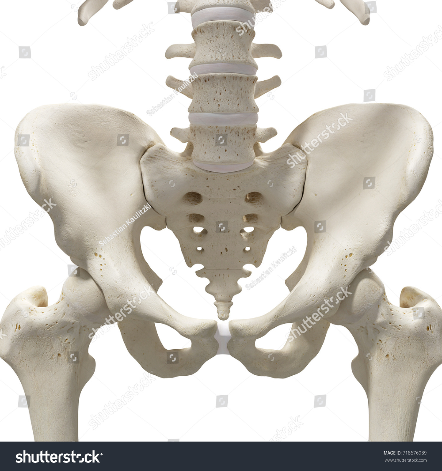 Medically Accurate 3d Rendering Hip Sacrum Stock Illustration 718676989 ...