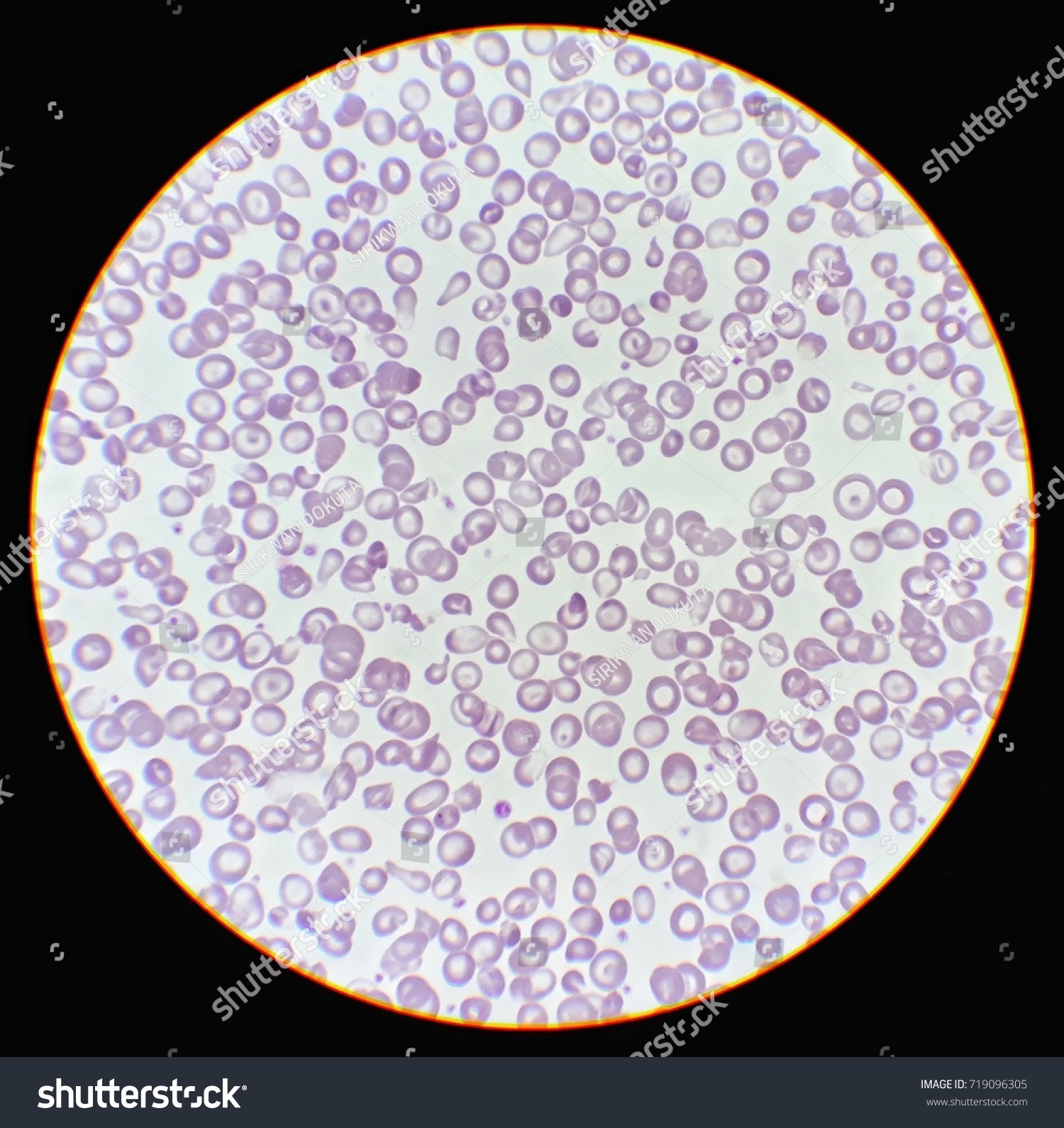 Human Blood Smear Under 100x Light Stock Photo 719096305 | Shutterstock