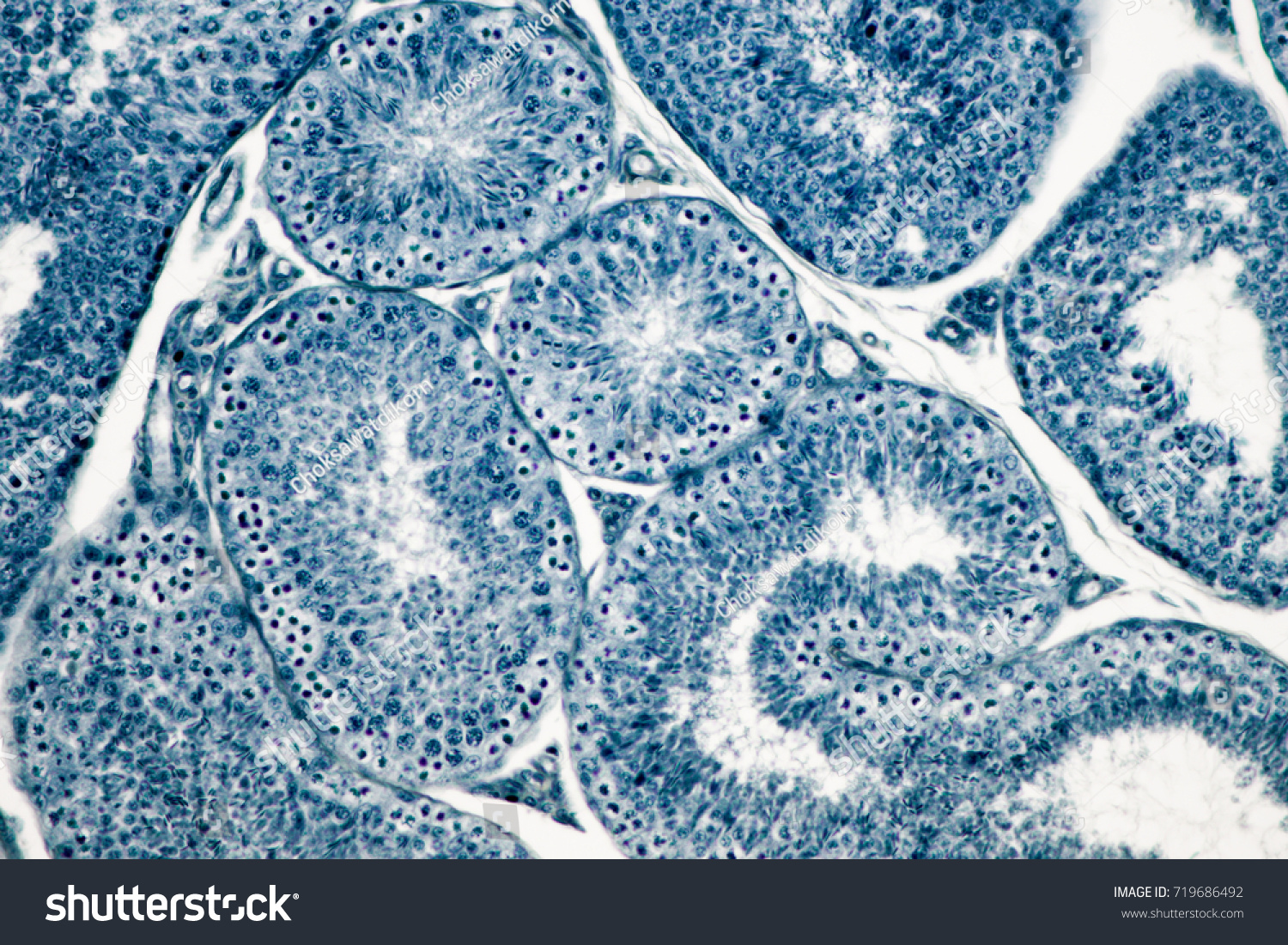 Cross Section Human Testis Under Microscope Stock Photo 719686492 ...