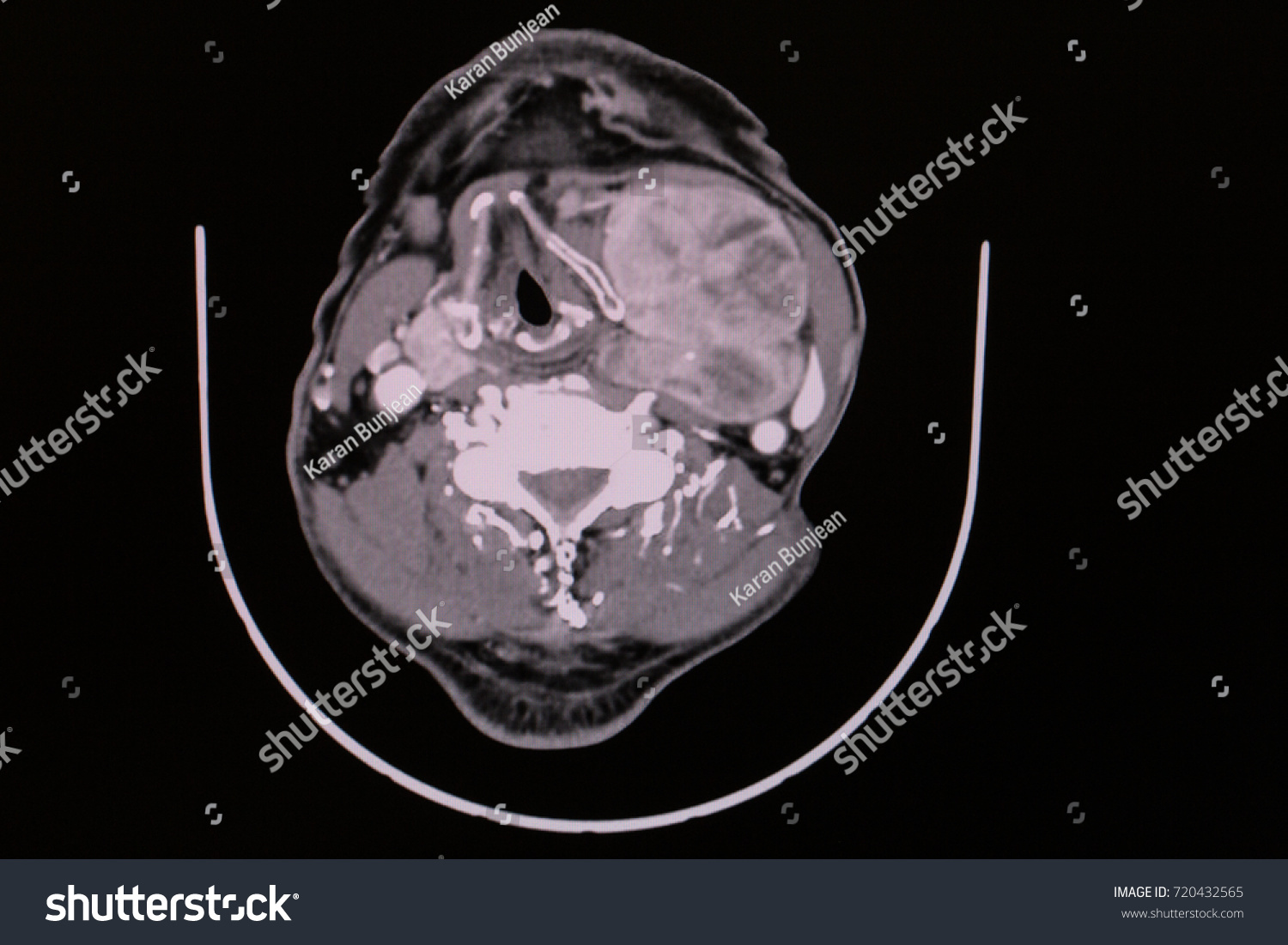 Axial Cut Sagittal View Ct Scan Stock Photo 720432565 | Shutterstock