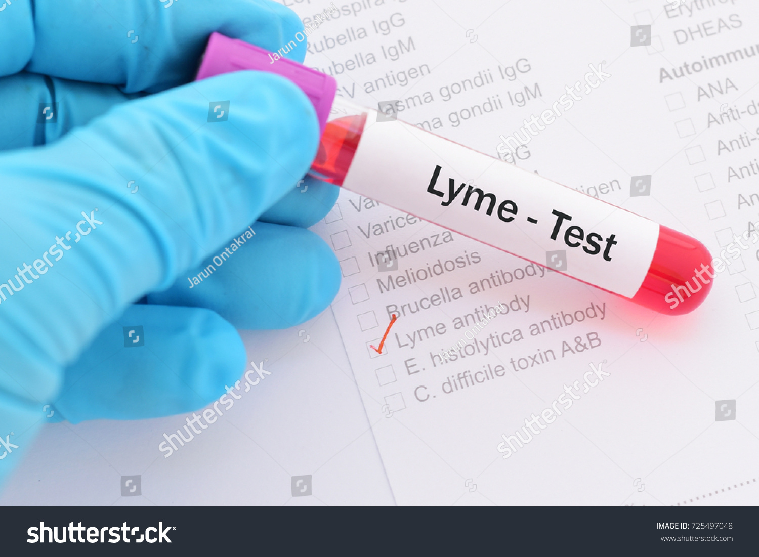 Blood Sample Lyme Disease Test Stock Photo 725497048 Shutterstock   Stock Photo Blood Sample For Lyme Disease Test 725497048 