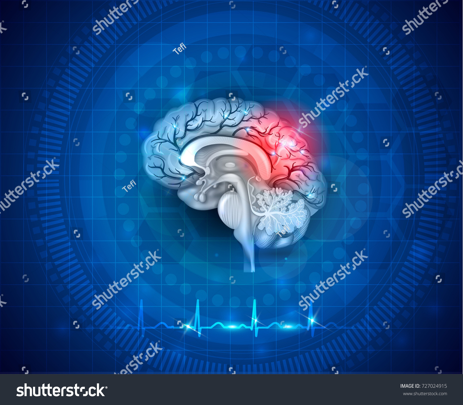 Human Brain Damage Treatment Concept 3d Stock Illustration 727024915 ...