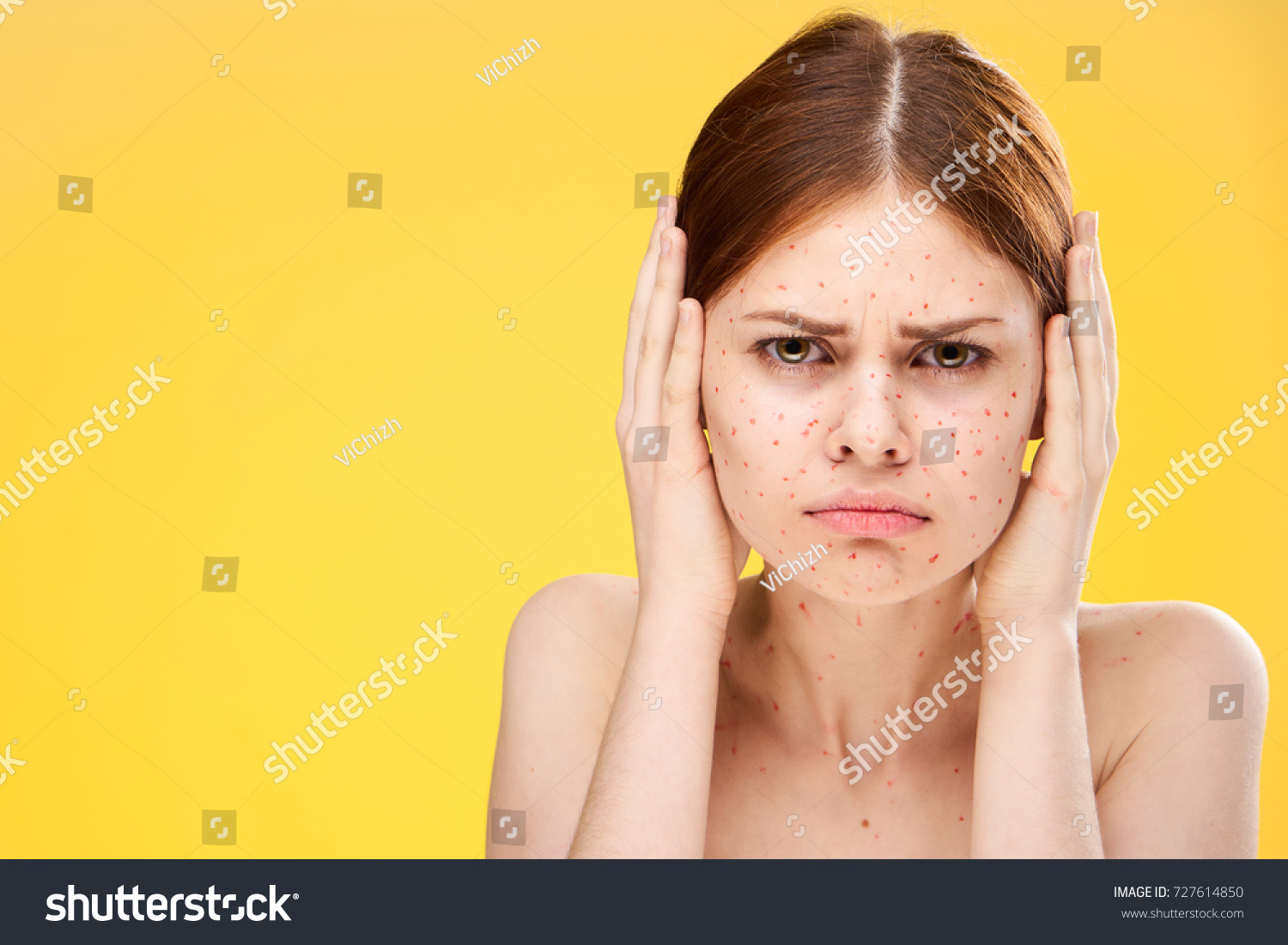 rash-red-dots-on-face-woman-stock-photo-727614850-shutterstock