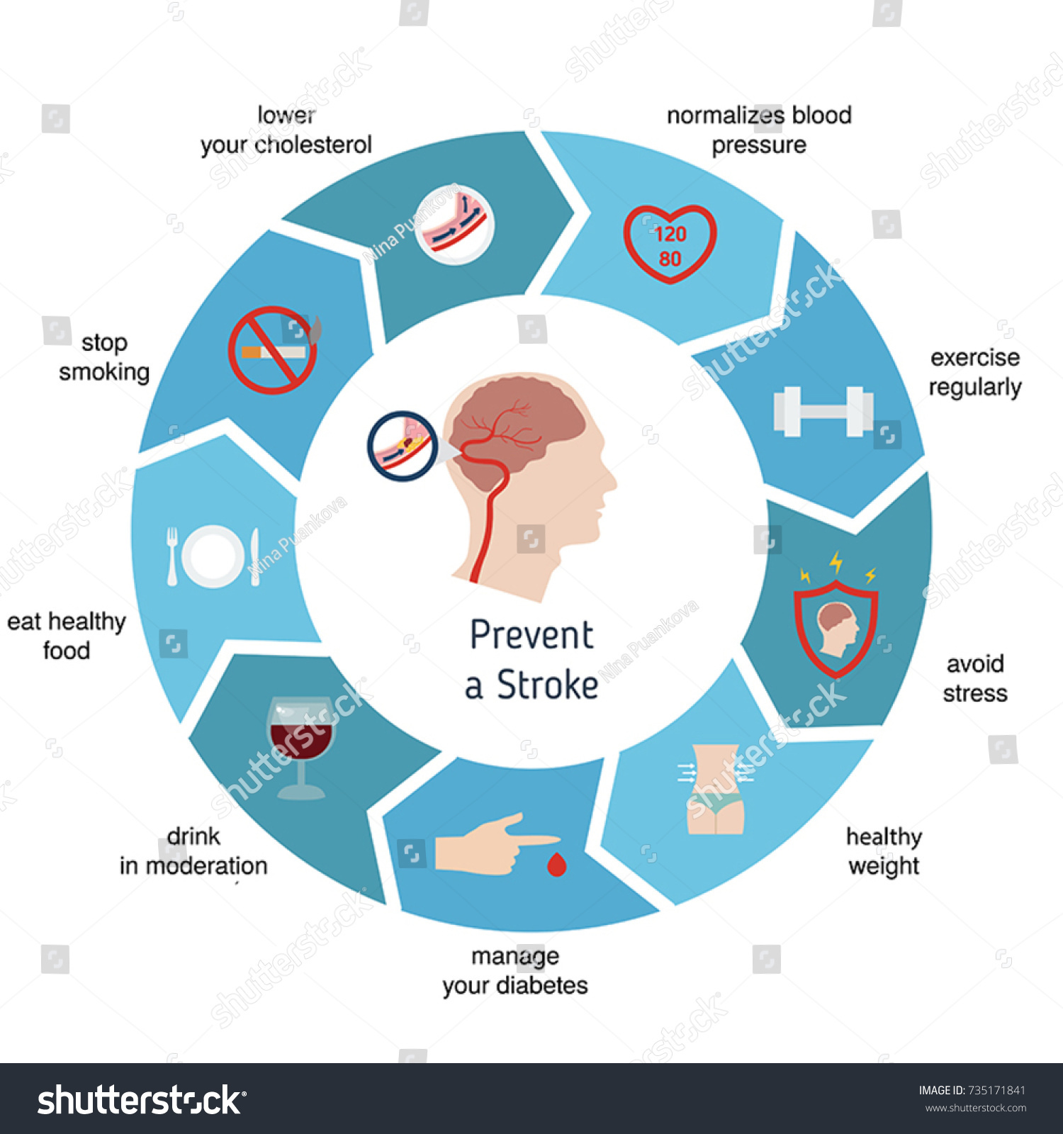 Infographics Stroke Prevent Stroke Vector Illustration Stock Vector ...