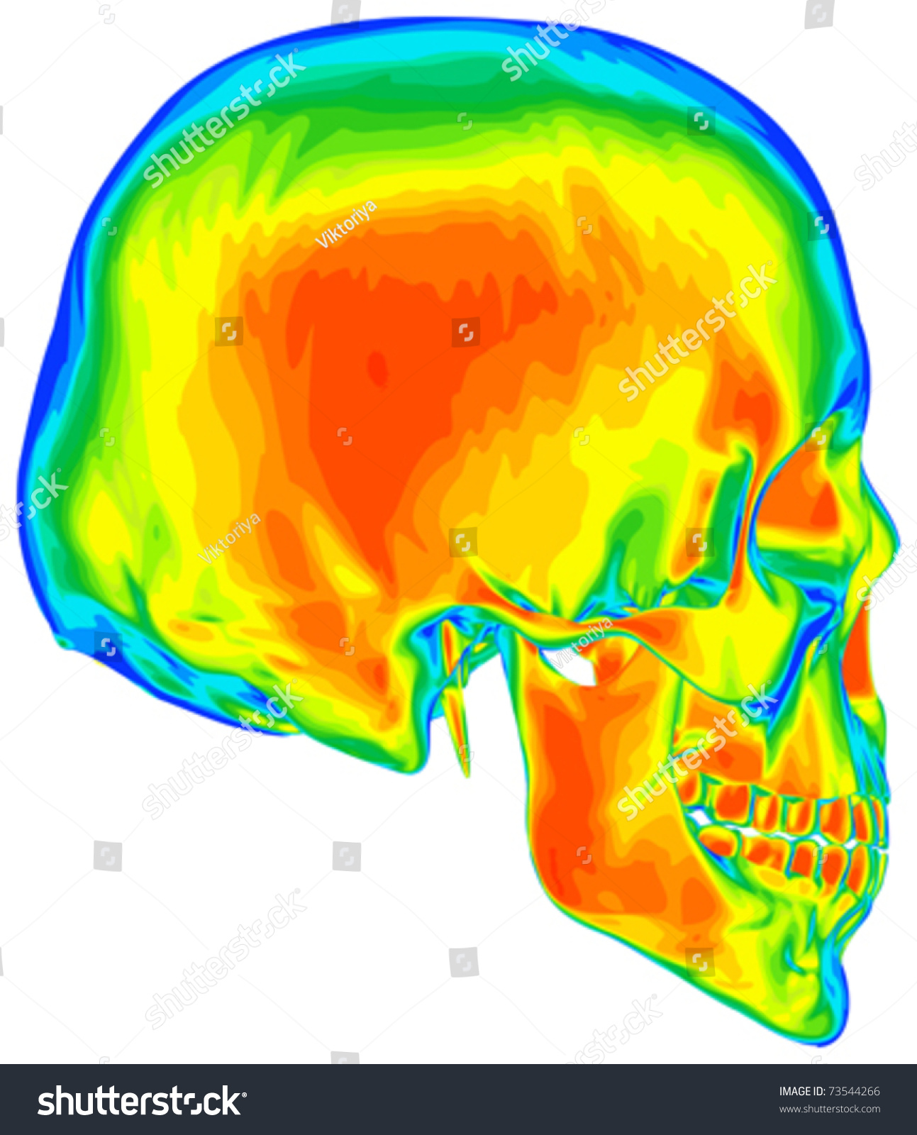 thermal skull