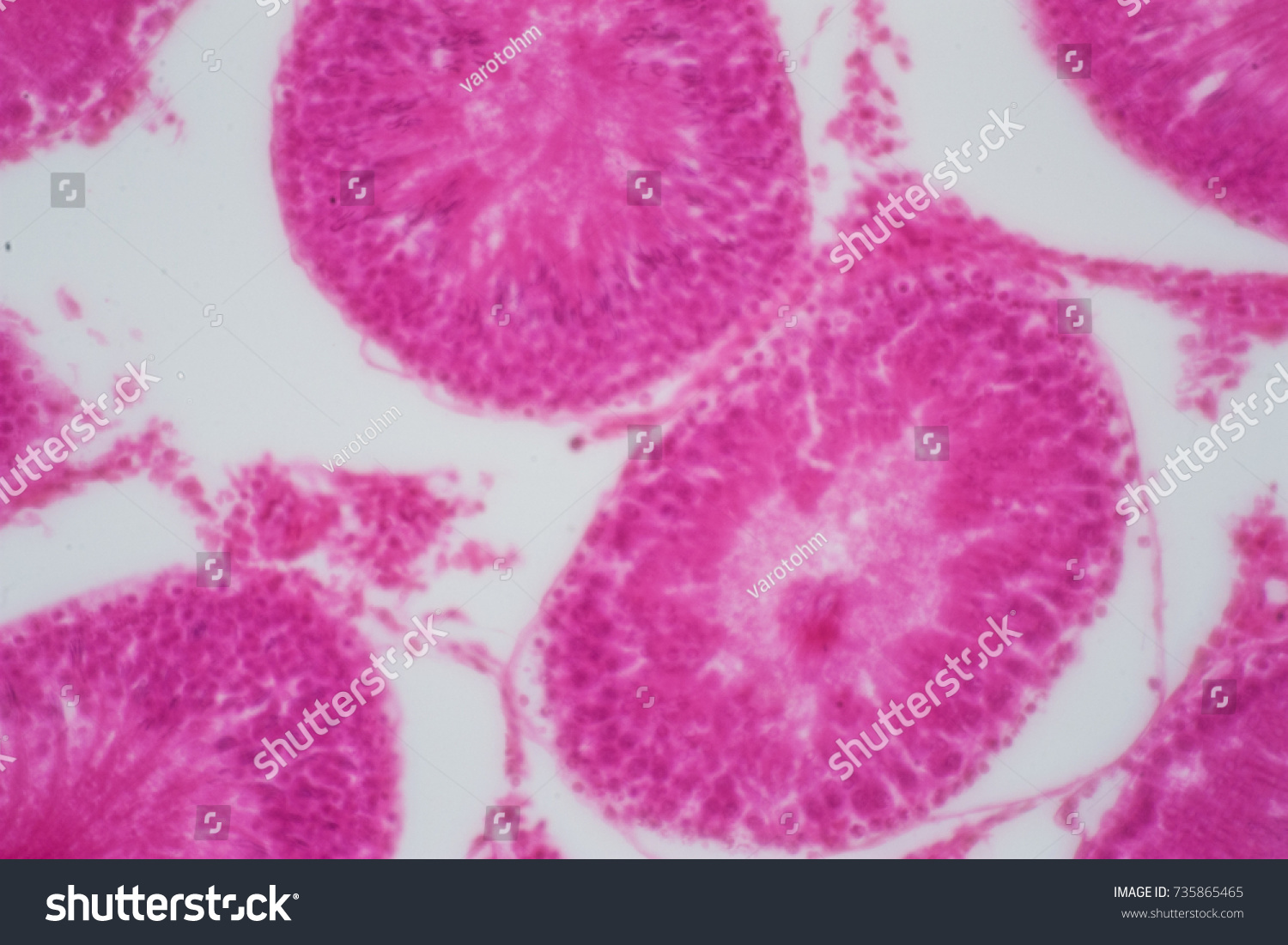 Cross Section Human Testis Under Microscope Stock Photo Shutterstock