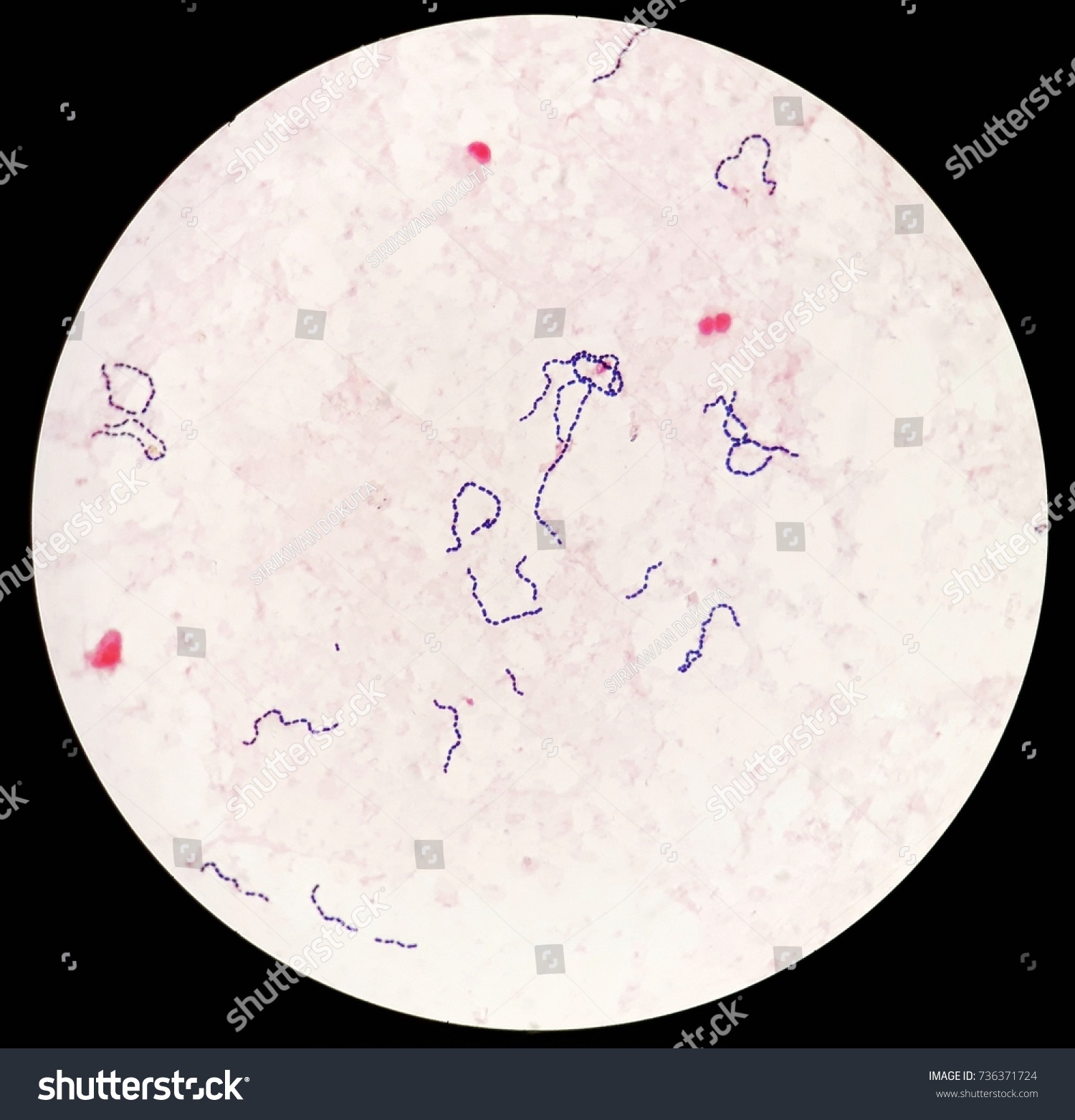 Smear Human Blood Culture Grams Stained Stock Photo 736371724 ...