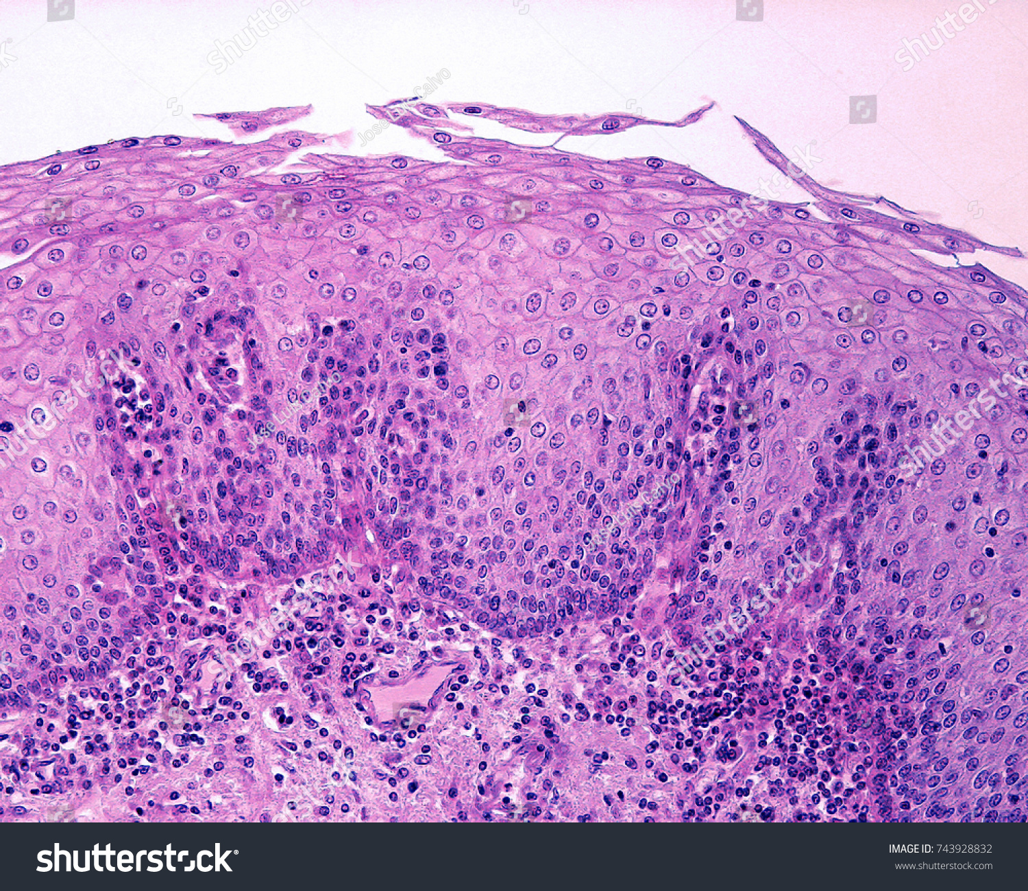 stratified squamous nonkeratinized epithelium esophagus