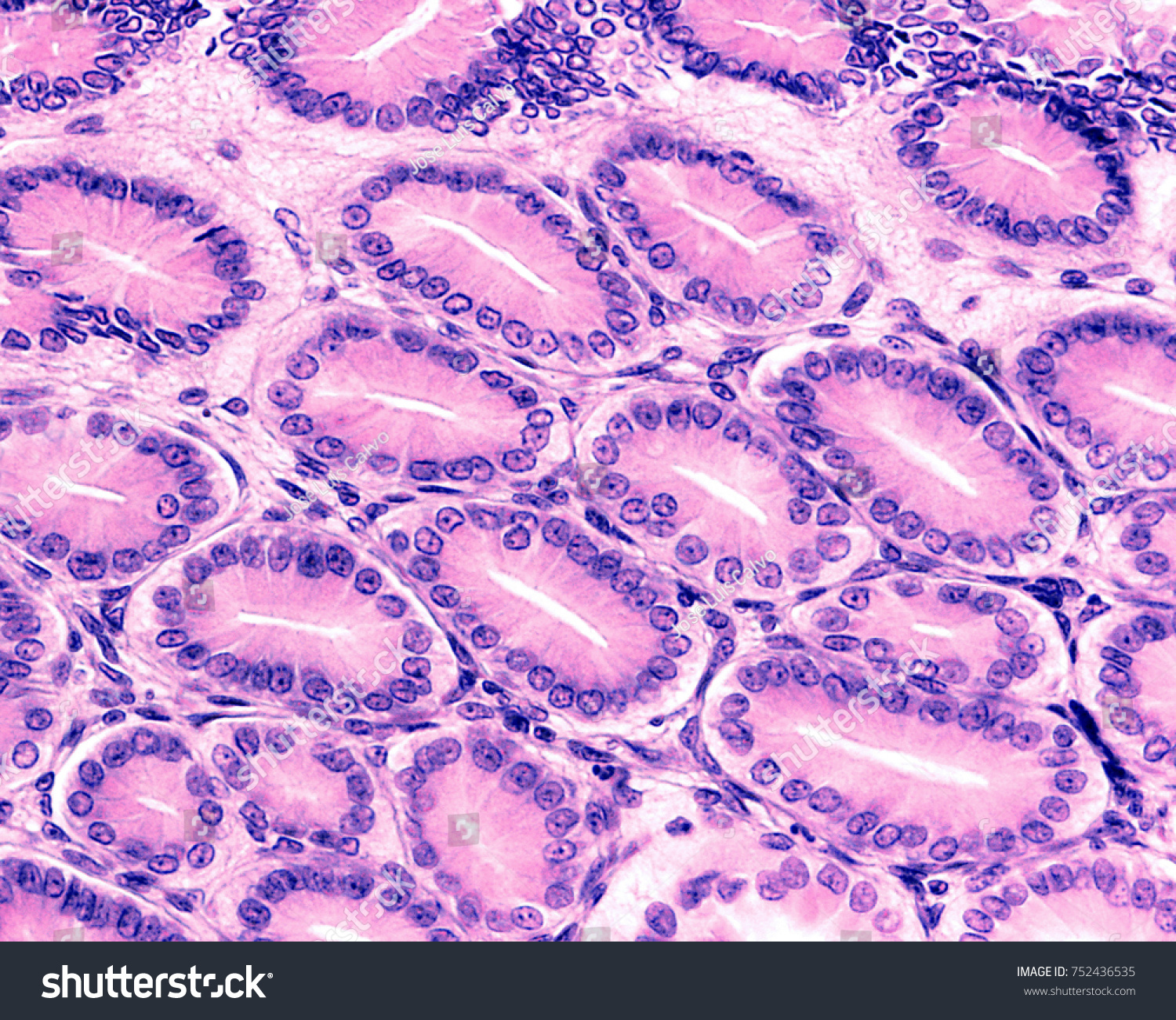 Cross Section Gastric Pits Lined By Stock Photo 752436535 | Shutterstock