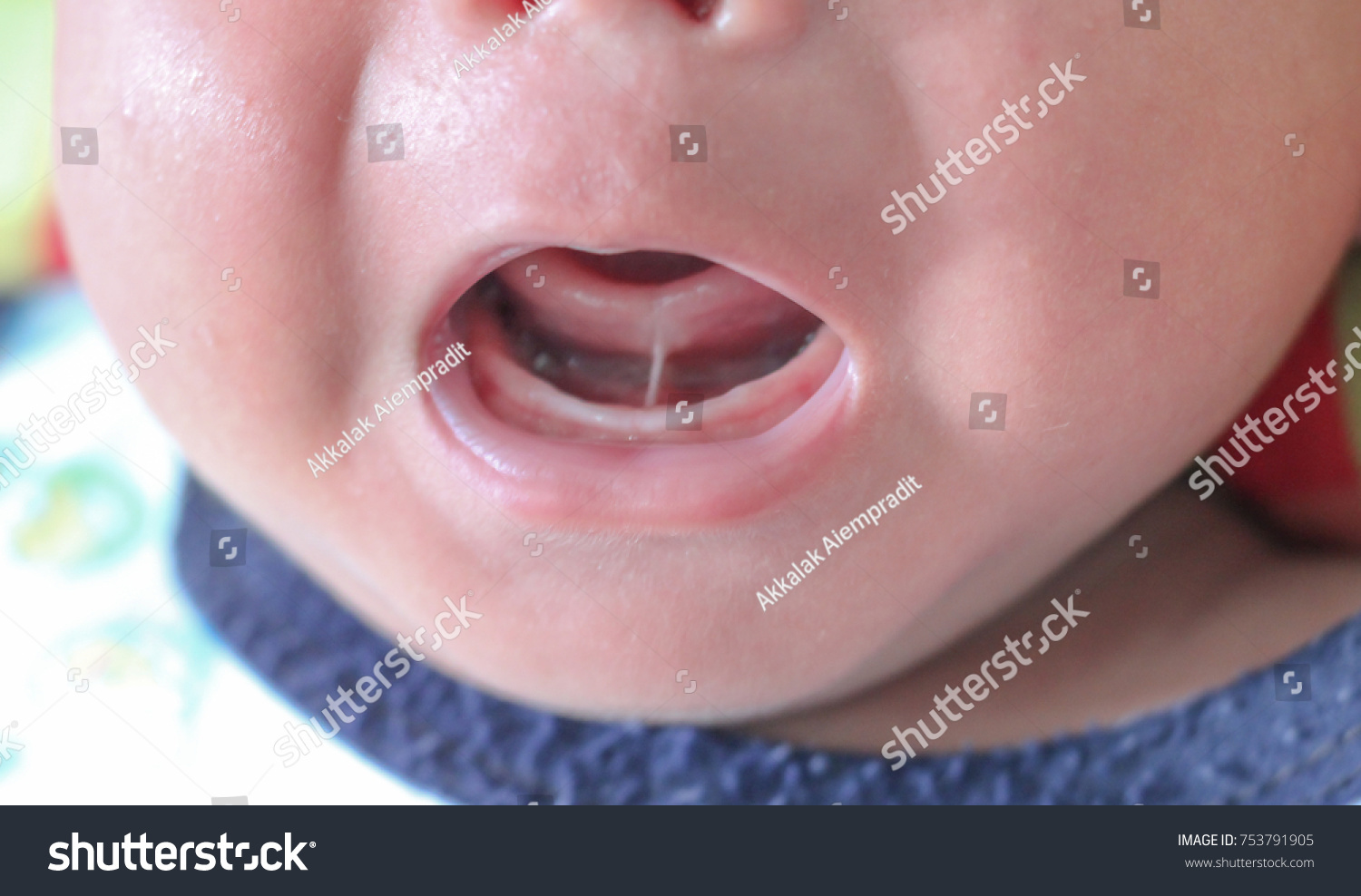 язык новорожденного фото