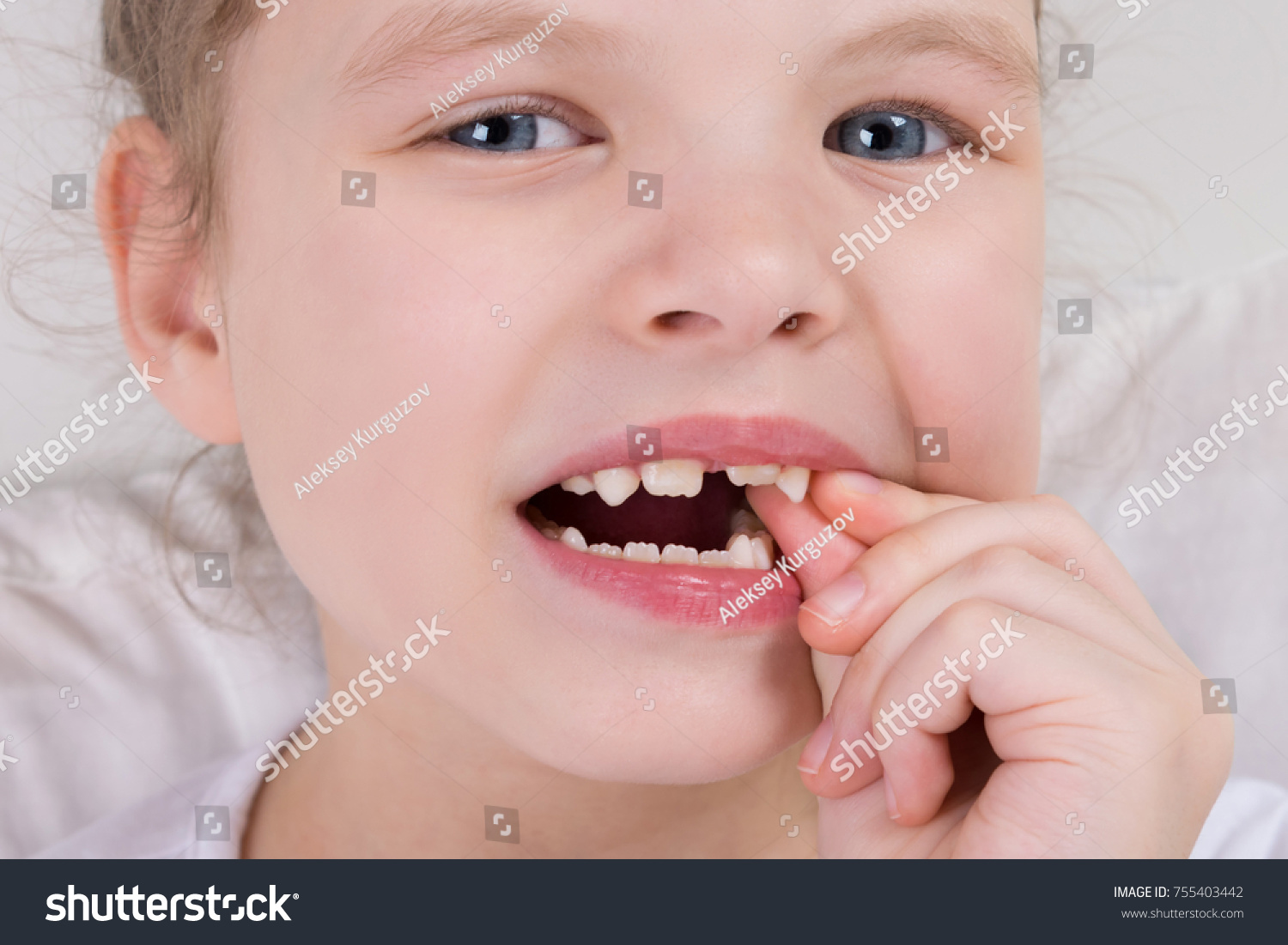 молочные зубы фото вырванных