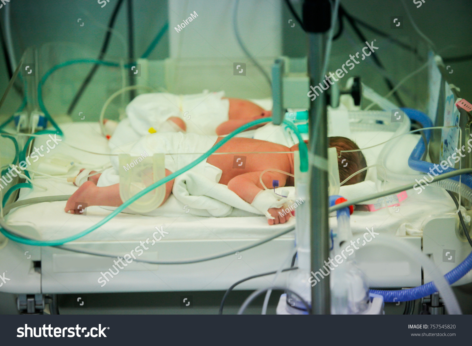 Premature Little Baby Incubator Neonatal Section Stock Photo 757545820 ...