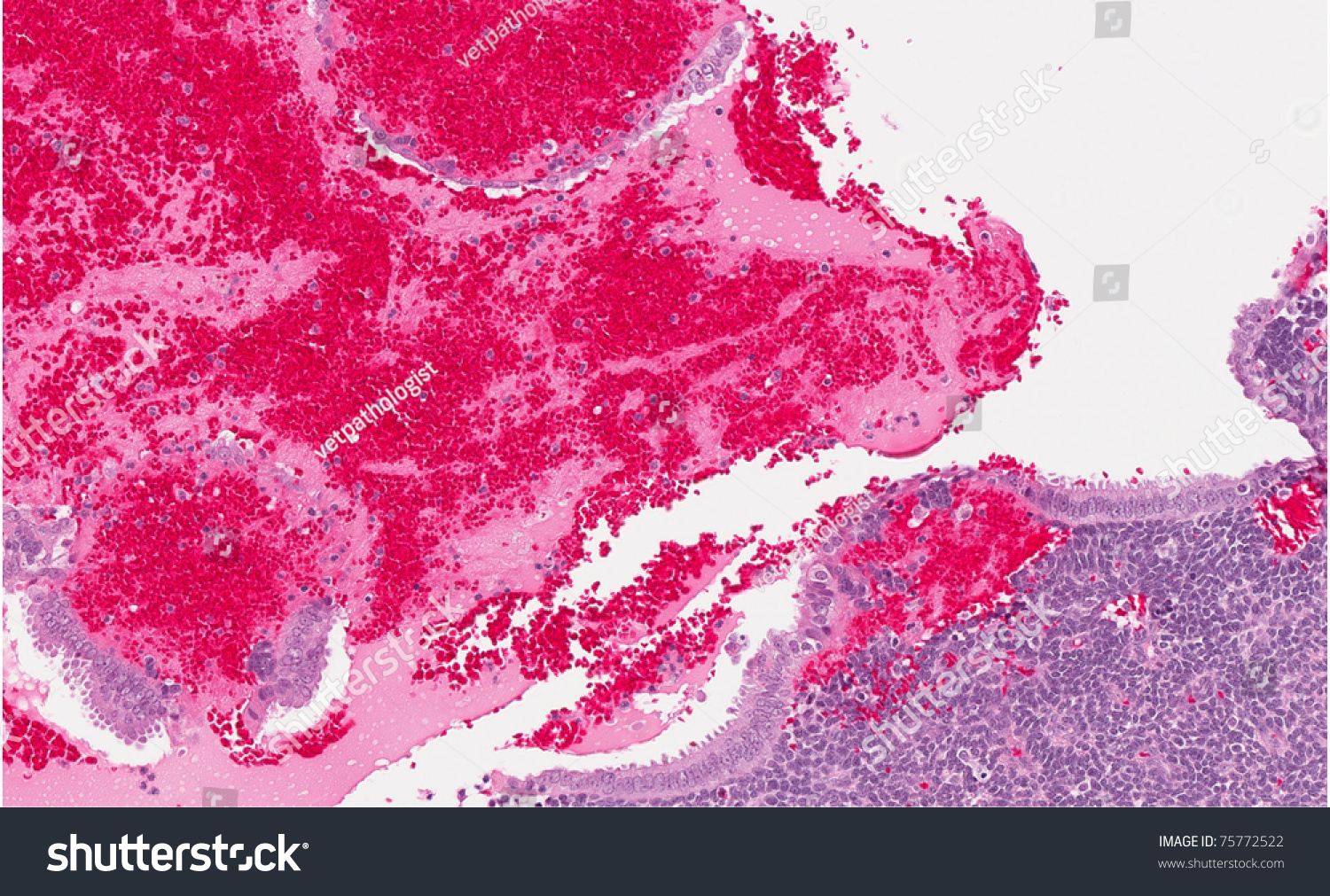 Highly Magnified Microscopic View Uterine Endometrium Stock Photo ...