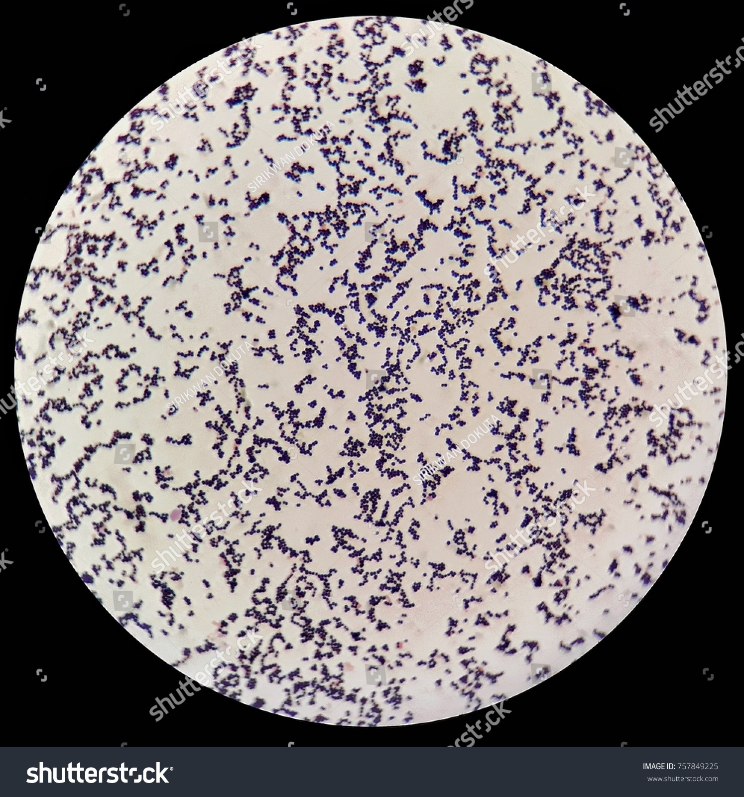 cocci bacteria under microscope