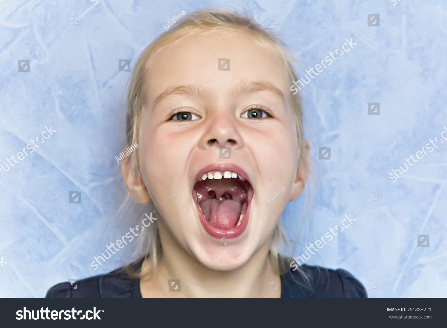 Девочка с открытым ртом
