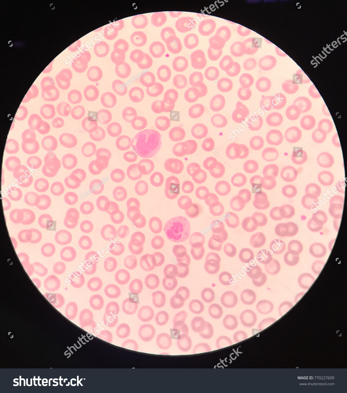 Monocyte Neutrophil On Blood Smear Stock Photo 770227609 | Shutterstock