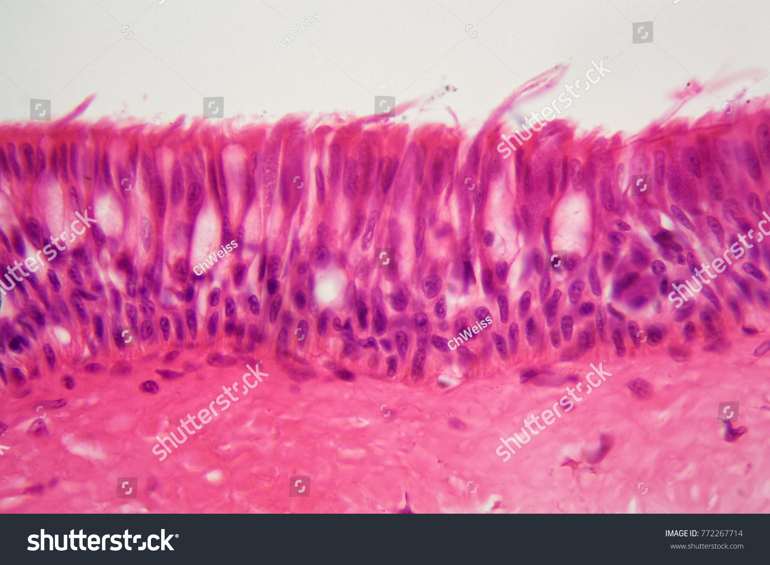 Cross Section Ciliated Epithelium Under Microscope Stock Photo ...