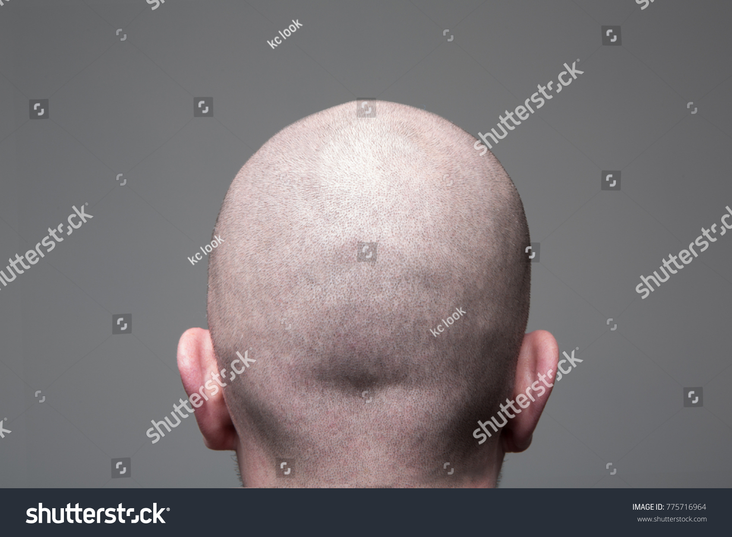 Shaved Head Back View Head Stock Photo 775716964 | Shutterstock