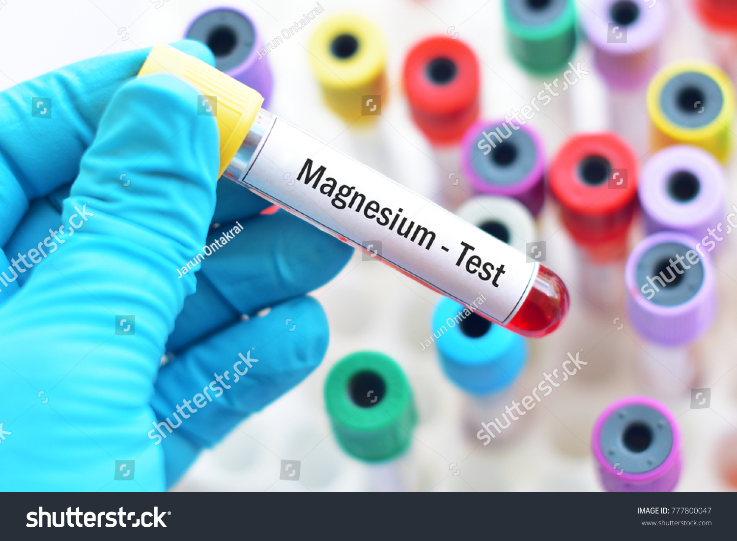 186 Magnesium Blood Test Images Stock Photos Vectors Shutterstock magnesium-blood-test
