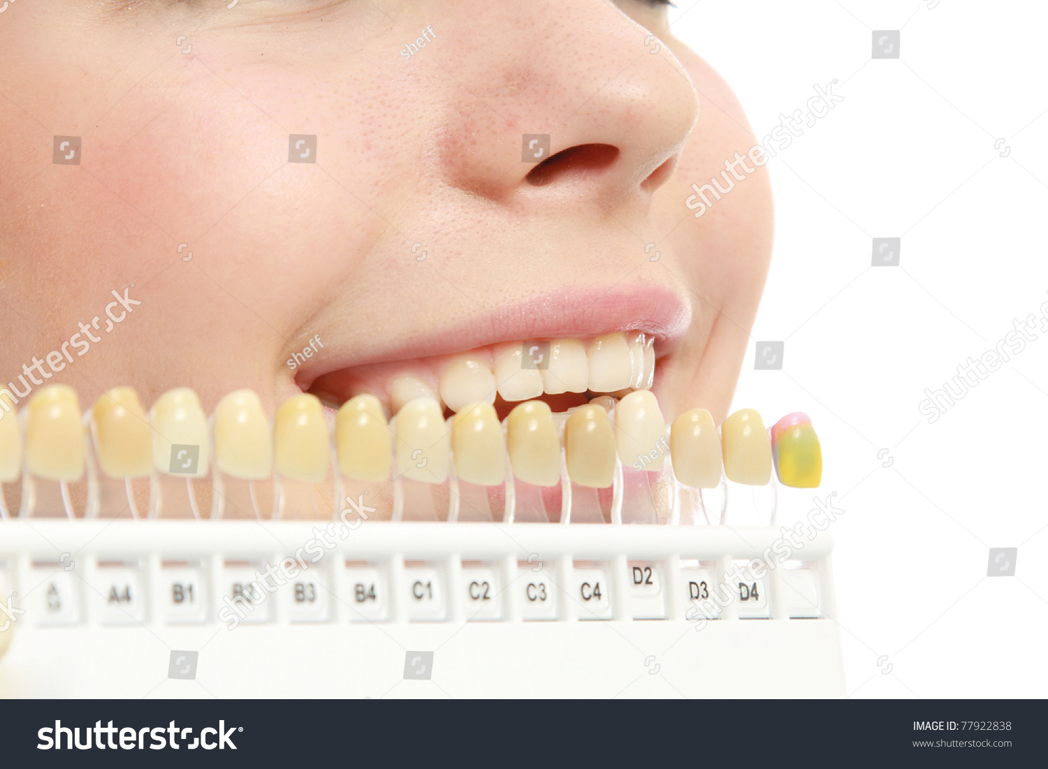 b1 цвет зубов фото