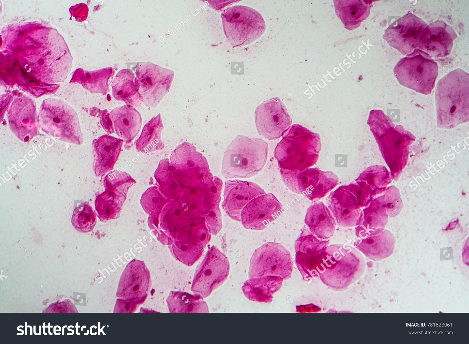 Epithelial Cells Bacteria Oral Cavity Stock Photo 781623061 