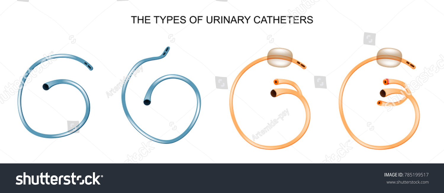 Types Urinary Catheters Stock Vector (Royalty Free) 785199517 ...